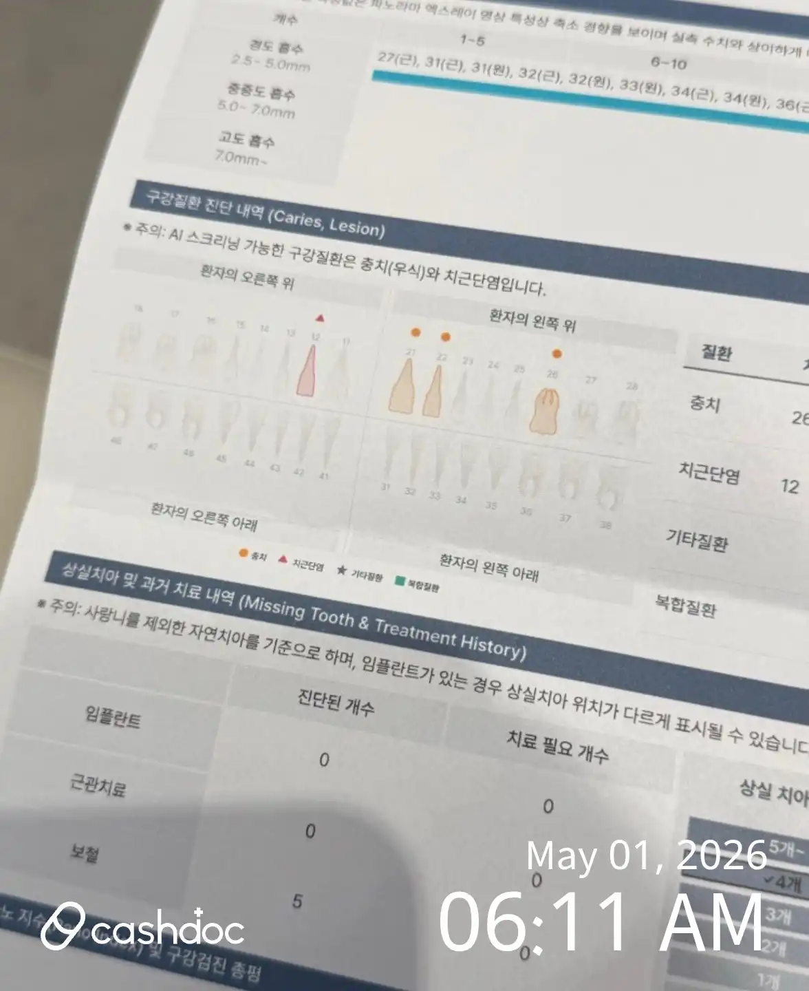 리뷰 사진