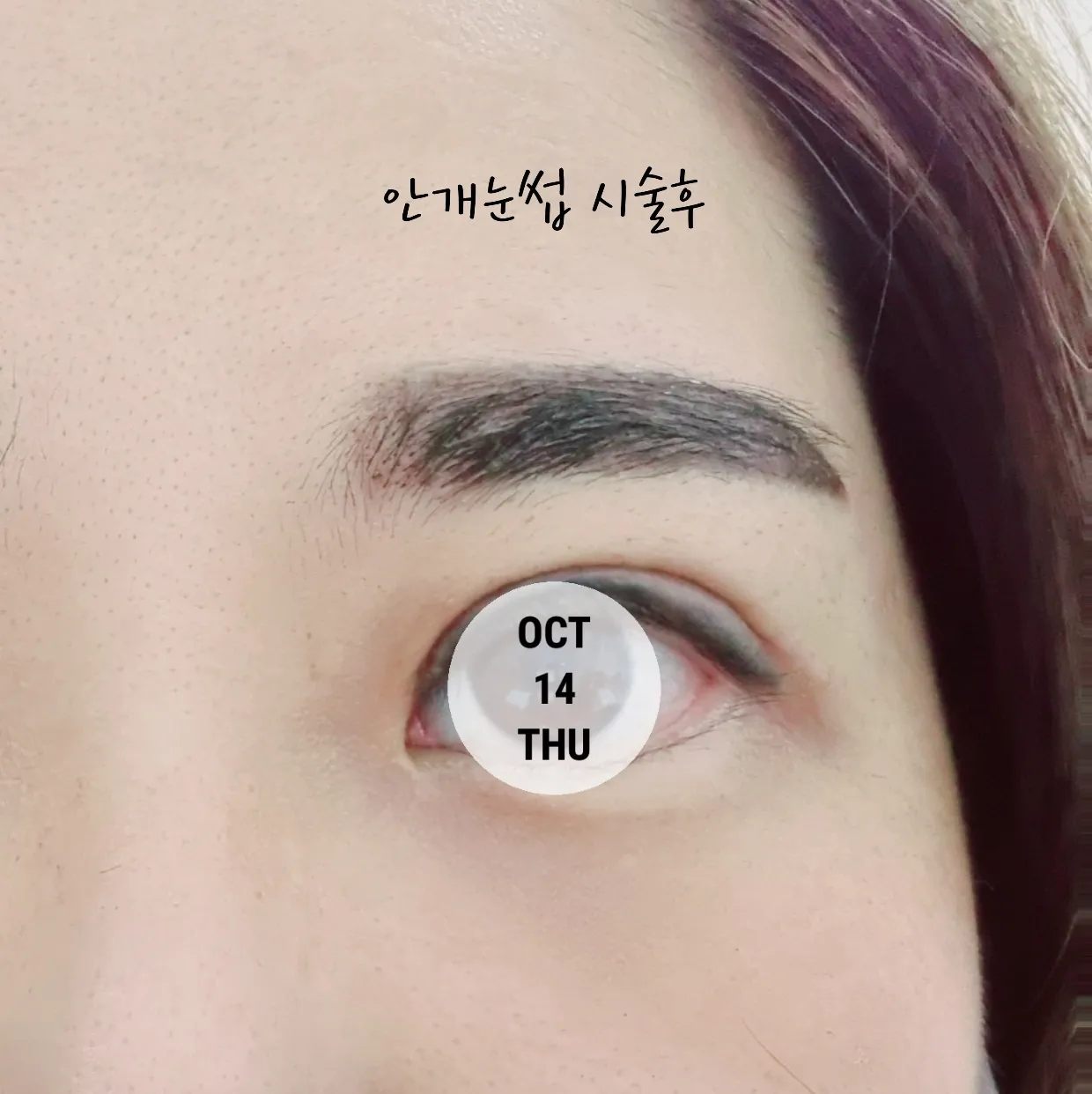 시술 후 — 미케이 반영구_눈썹, 입술, 아이라인