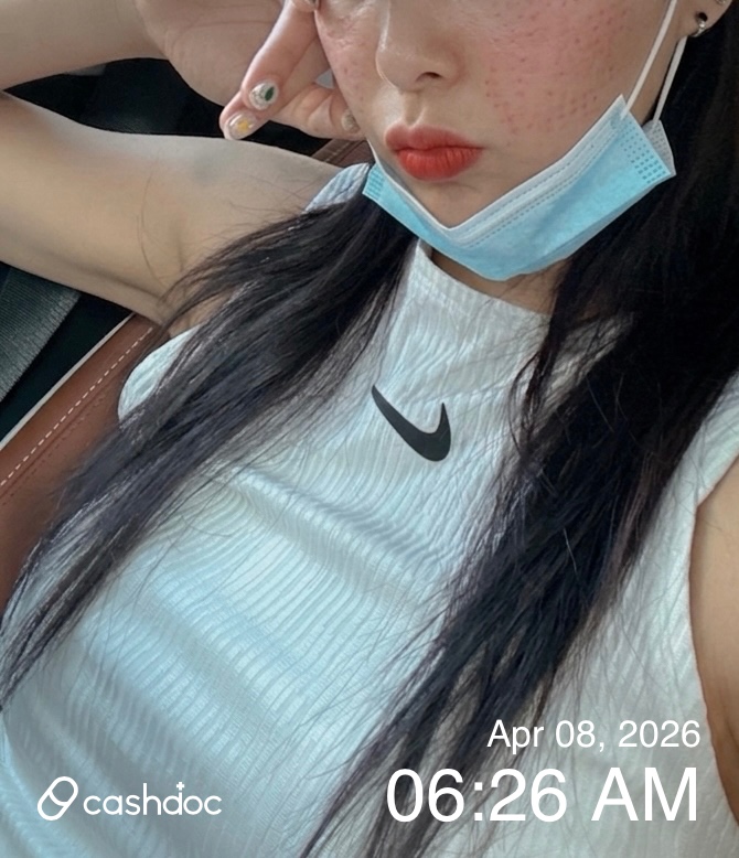 천안시 유앤아이의원에서 리쥬란 시술 후 피부 변화 체험