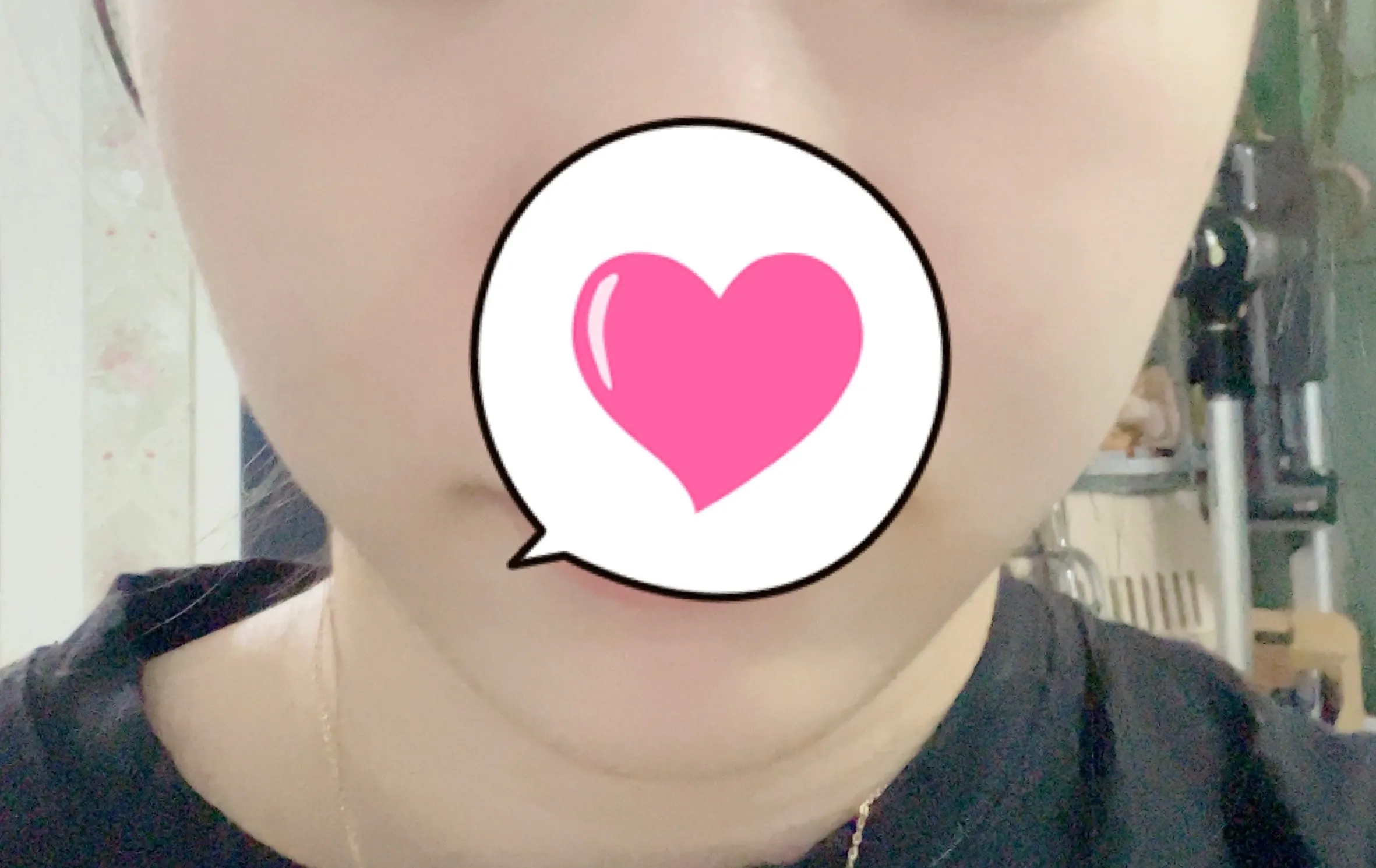 시술 후 — 인모드 리프팅
