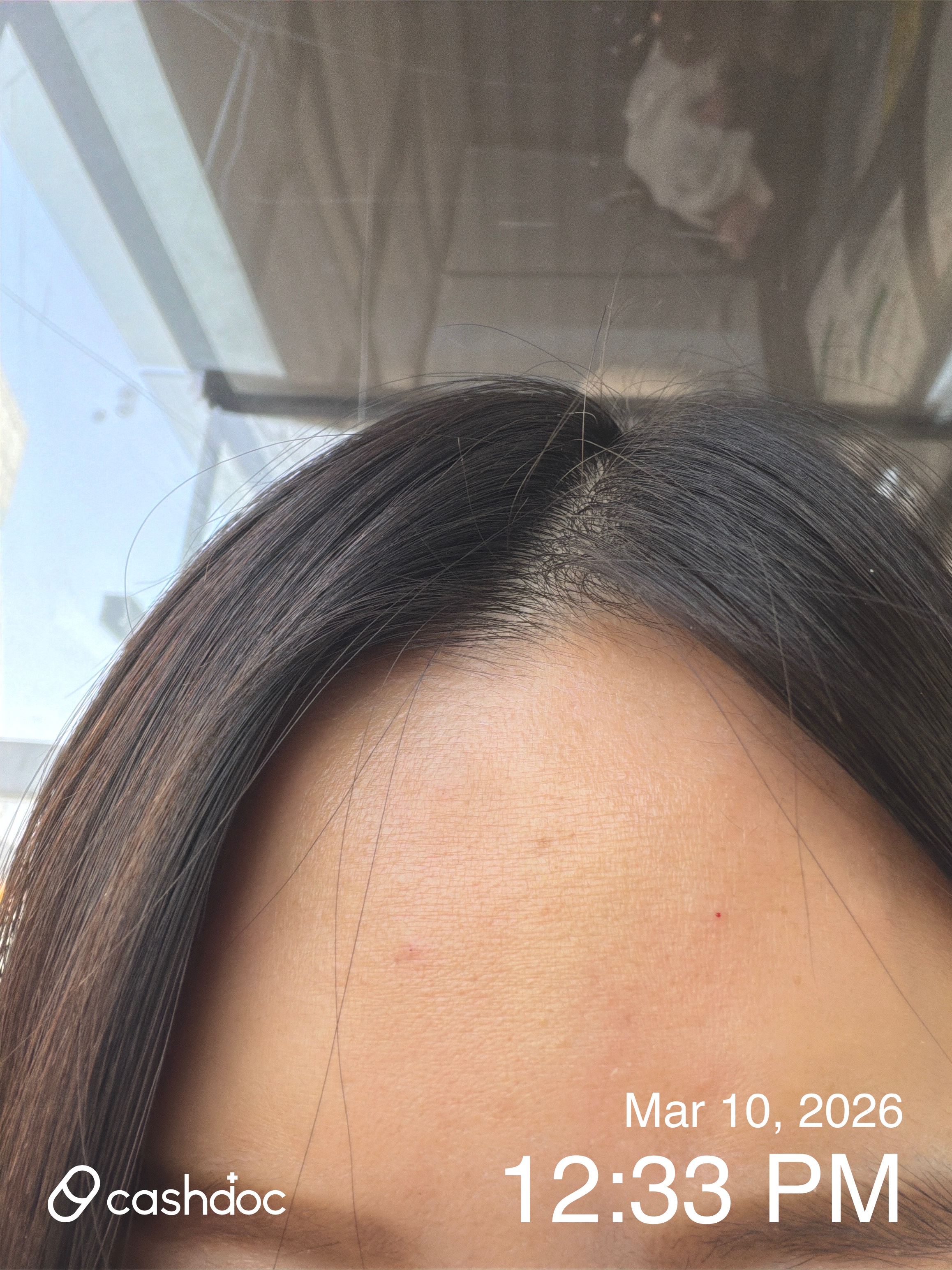 성북구 메이퓨어의원 미아점, 보톡스 시술 빠르고 친절해요