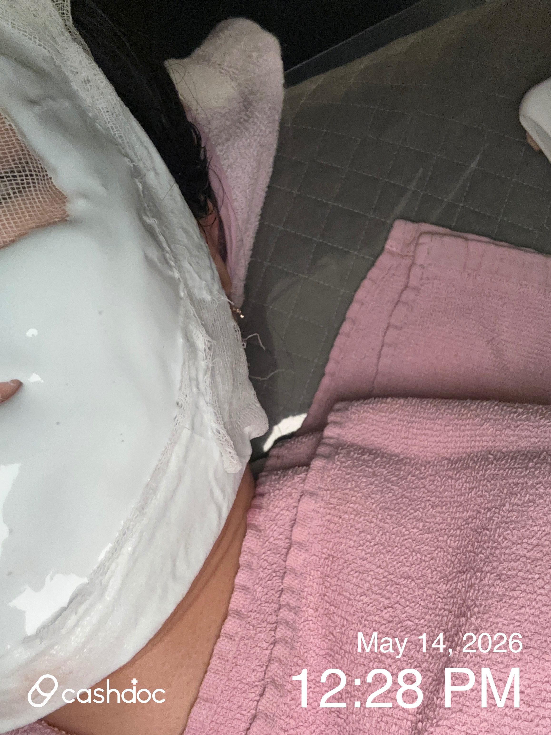 I am satisfied with the Aqua Peel and Cryo treatments I had at Blivi Clinic in Bupyeong-gu!