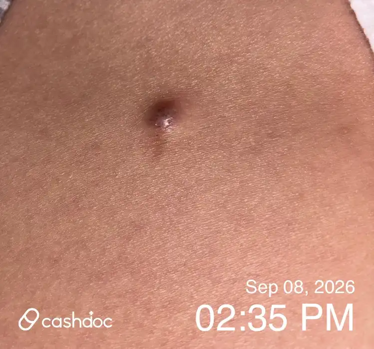 Review photo