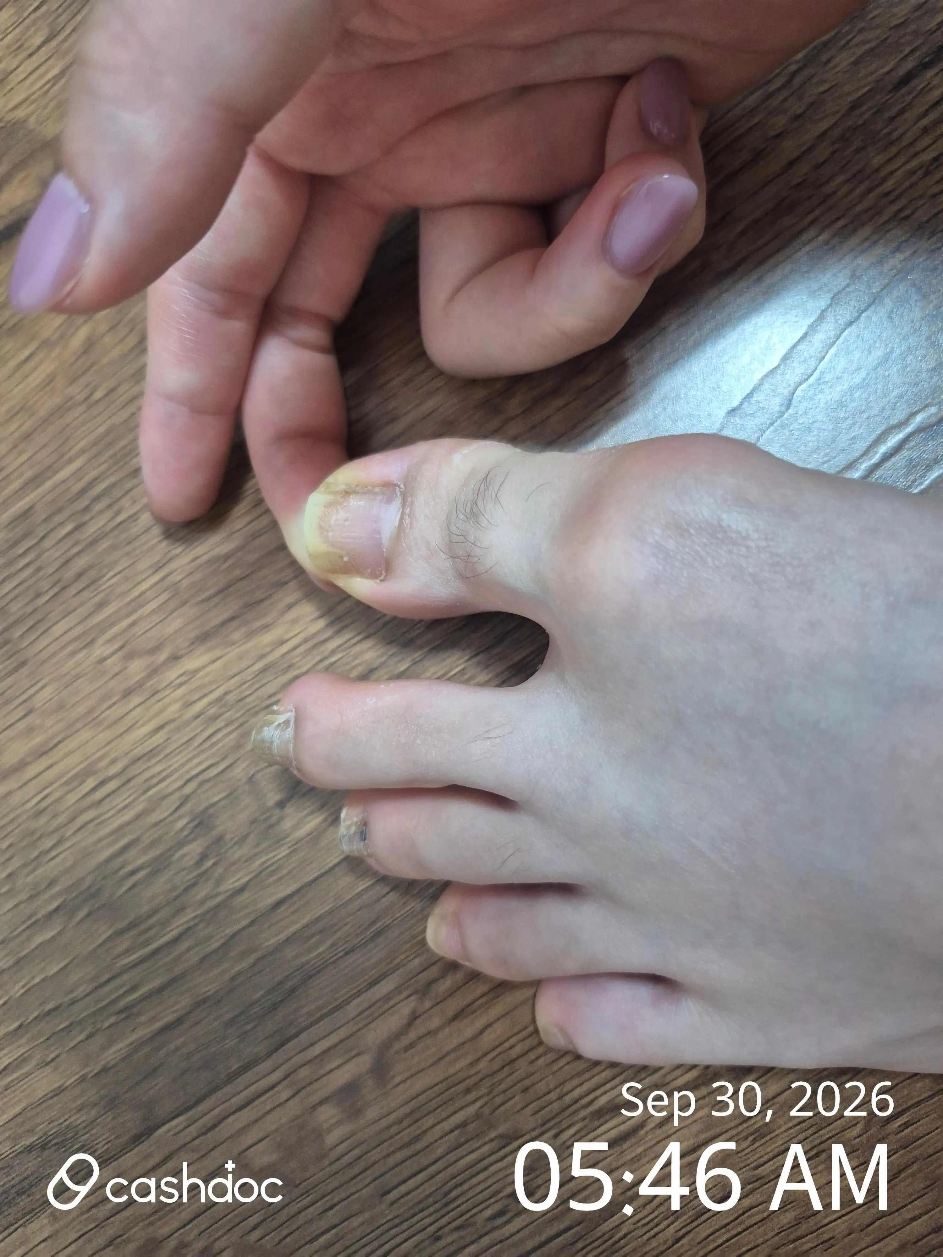评价照片
