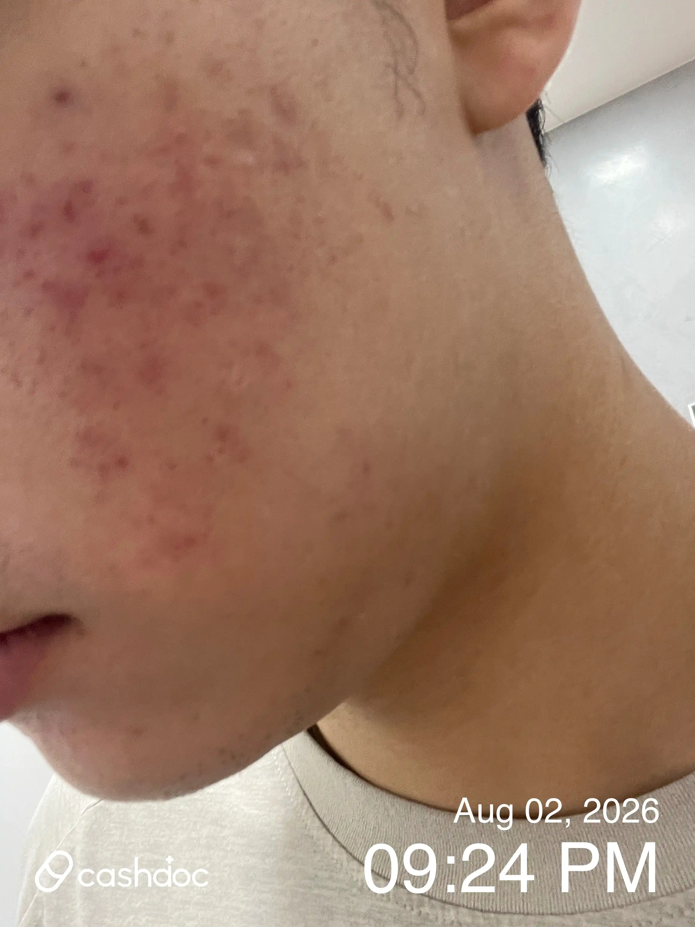 Review photo