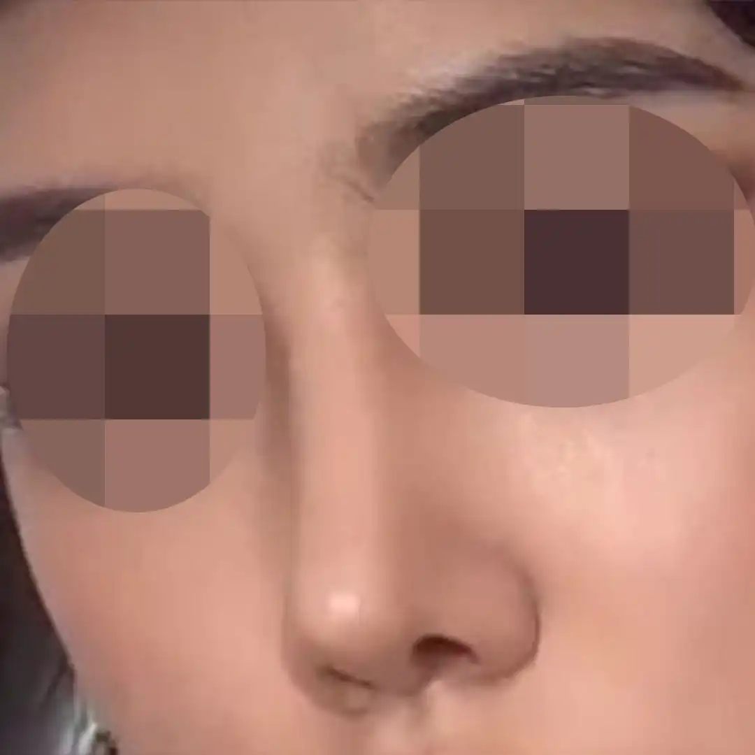 후