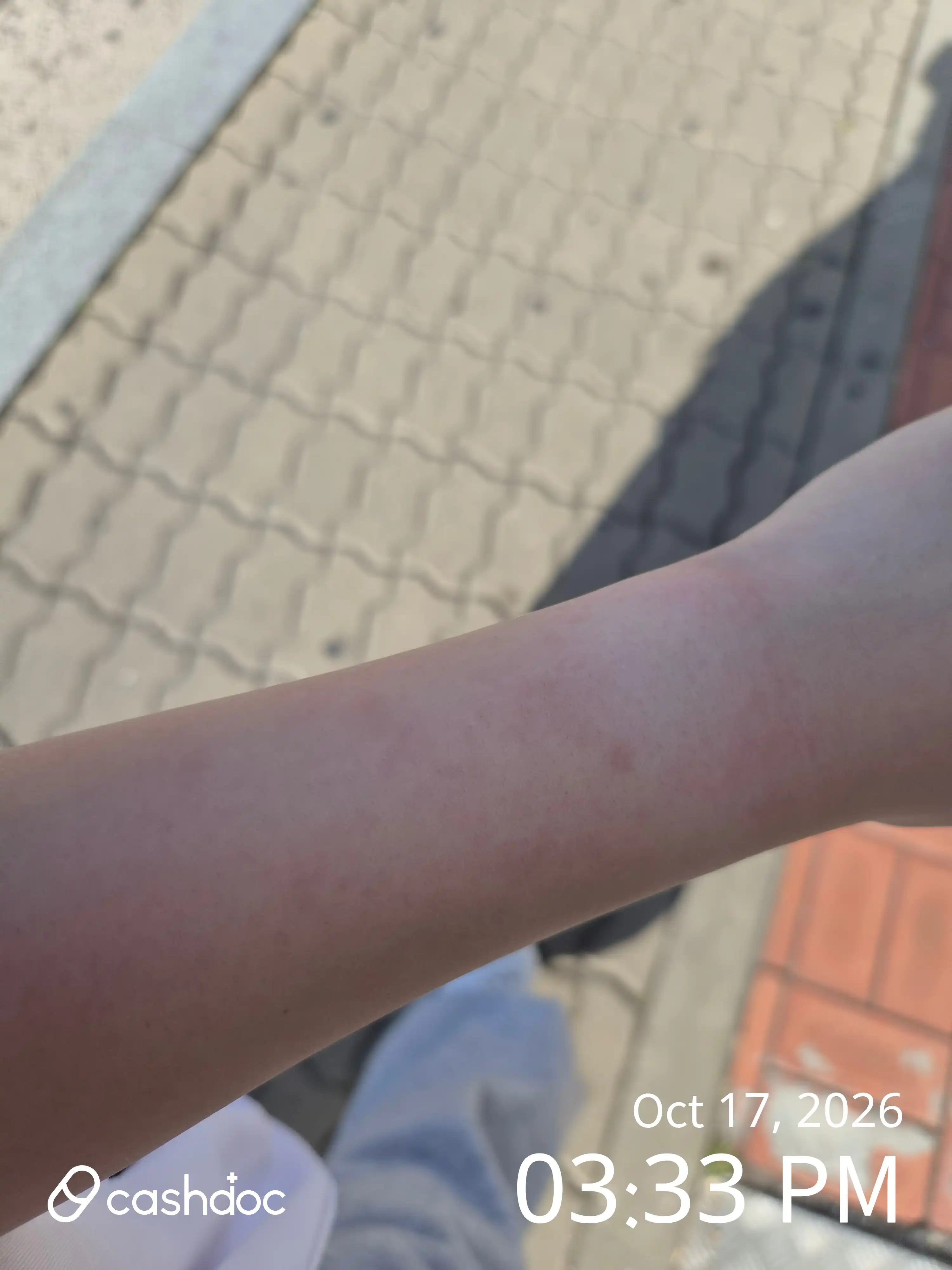 美璞诊所 东柏分院 评价照片