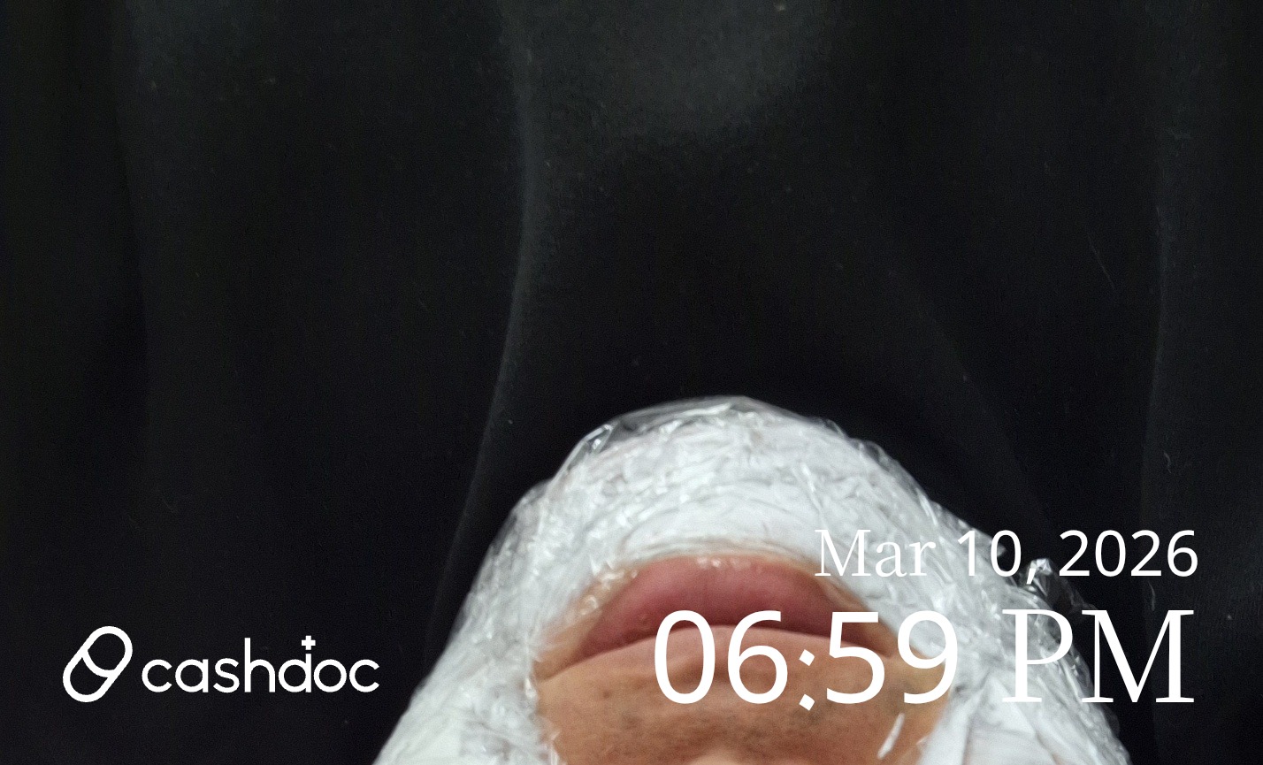 시흥시 은행의원에서 트러블 피부 진료 후기