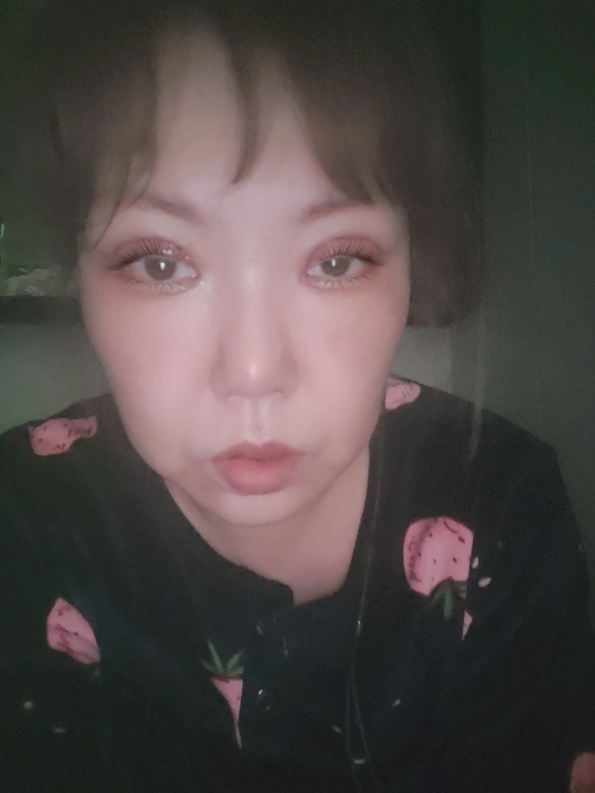 시술 후 — 드레스 단단듀얼트임