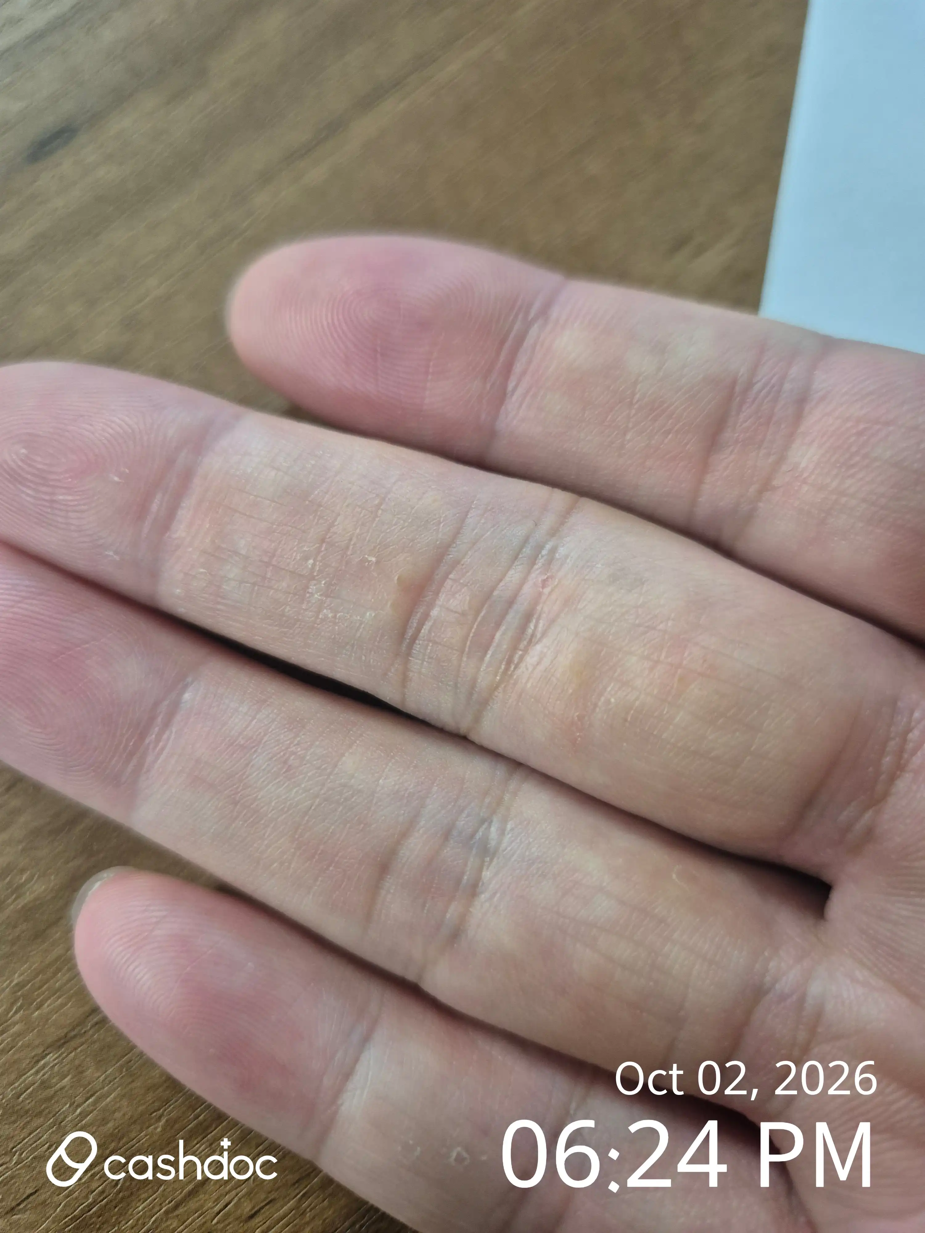 评价照片