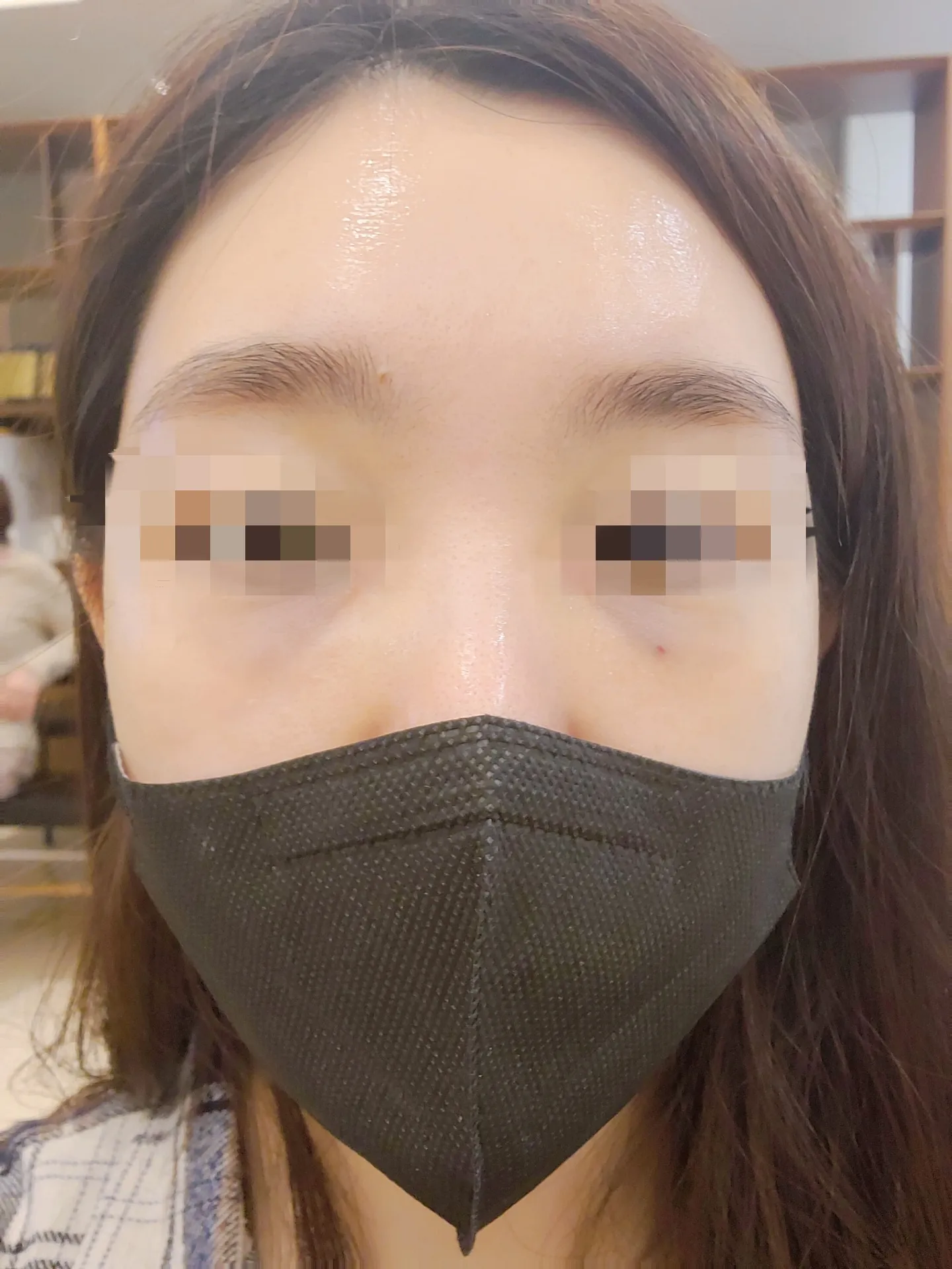 시술 후 사진