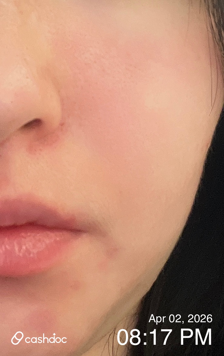 전주시 수경피부과의원, 피부 질환 치료 후기