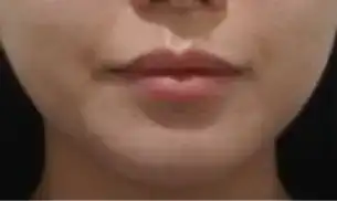 후