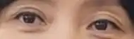 전
