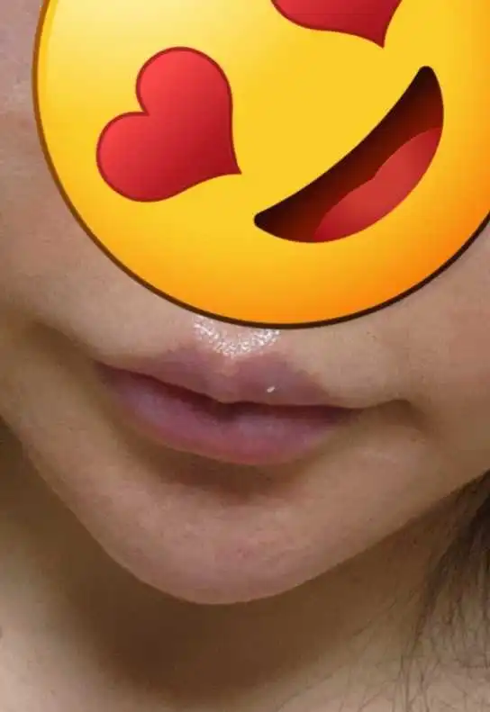 후