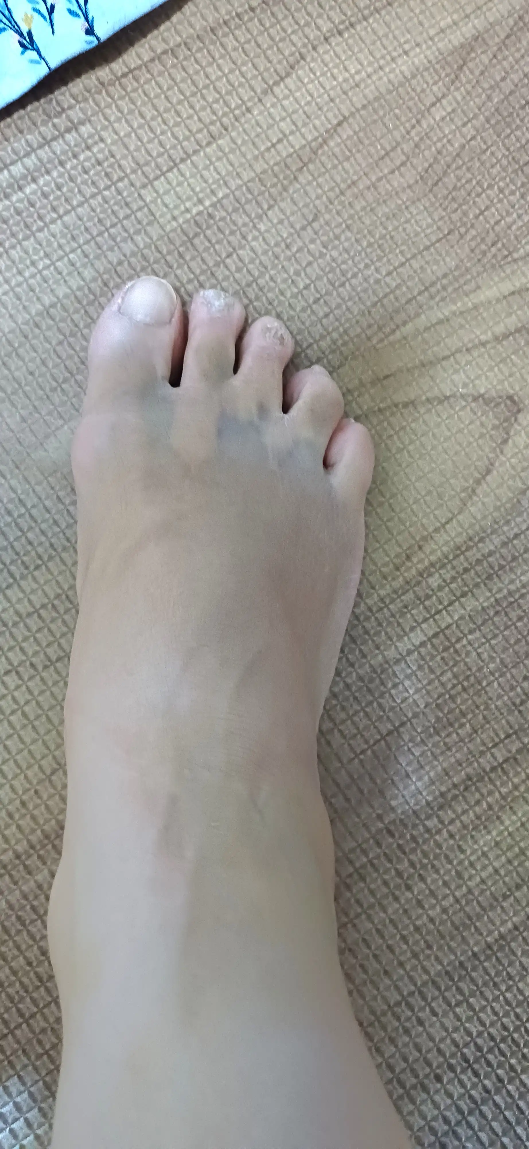 评价照片