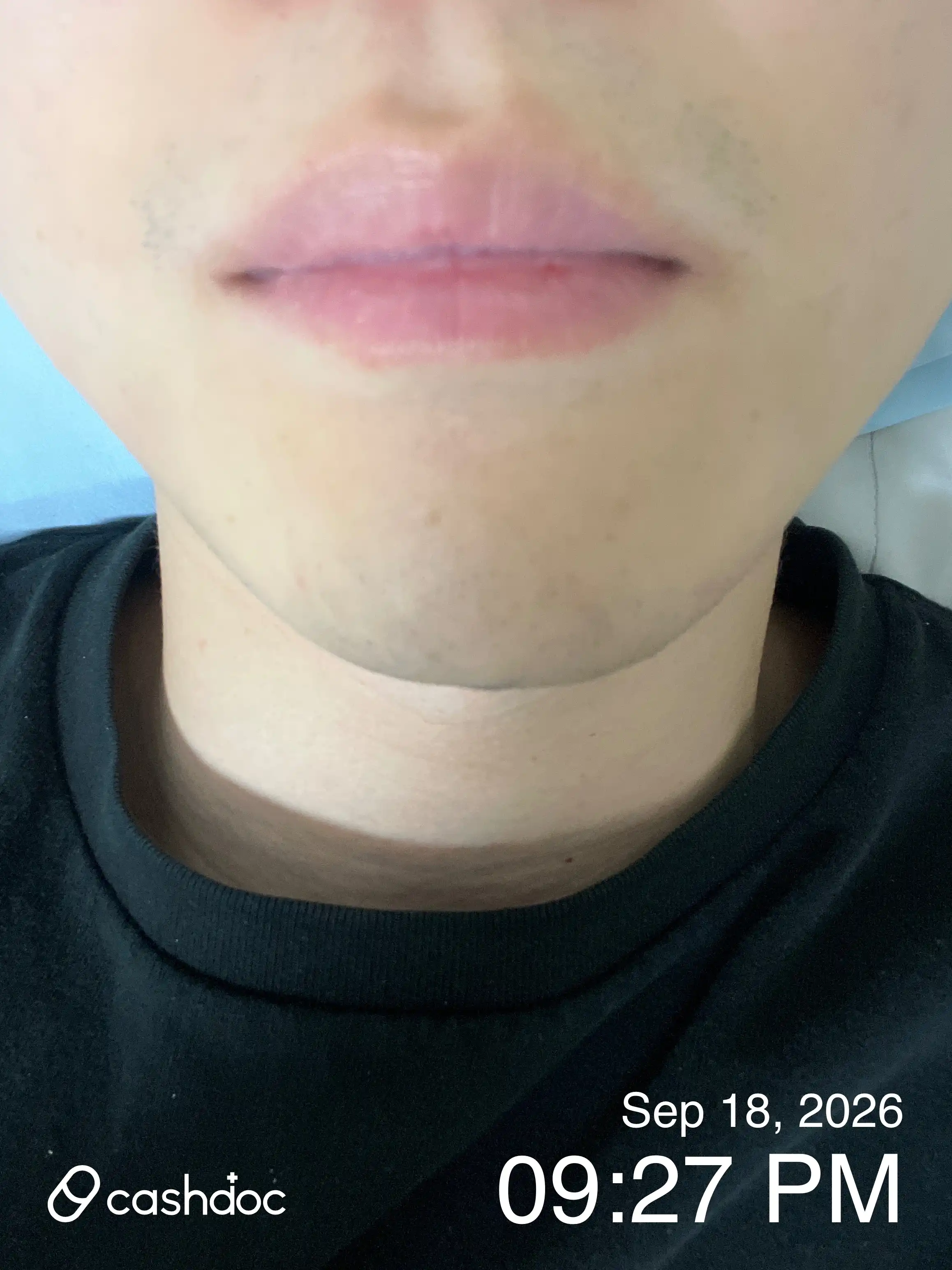 Review photo