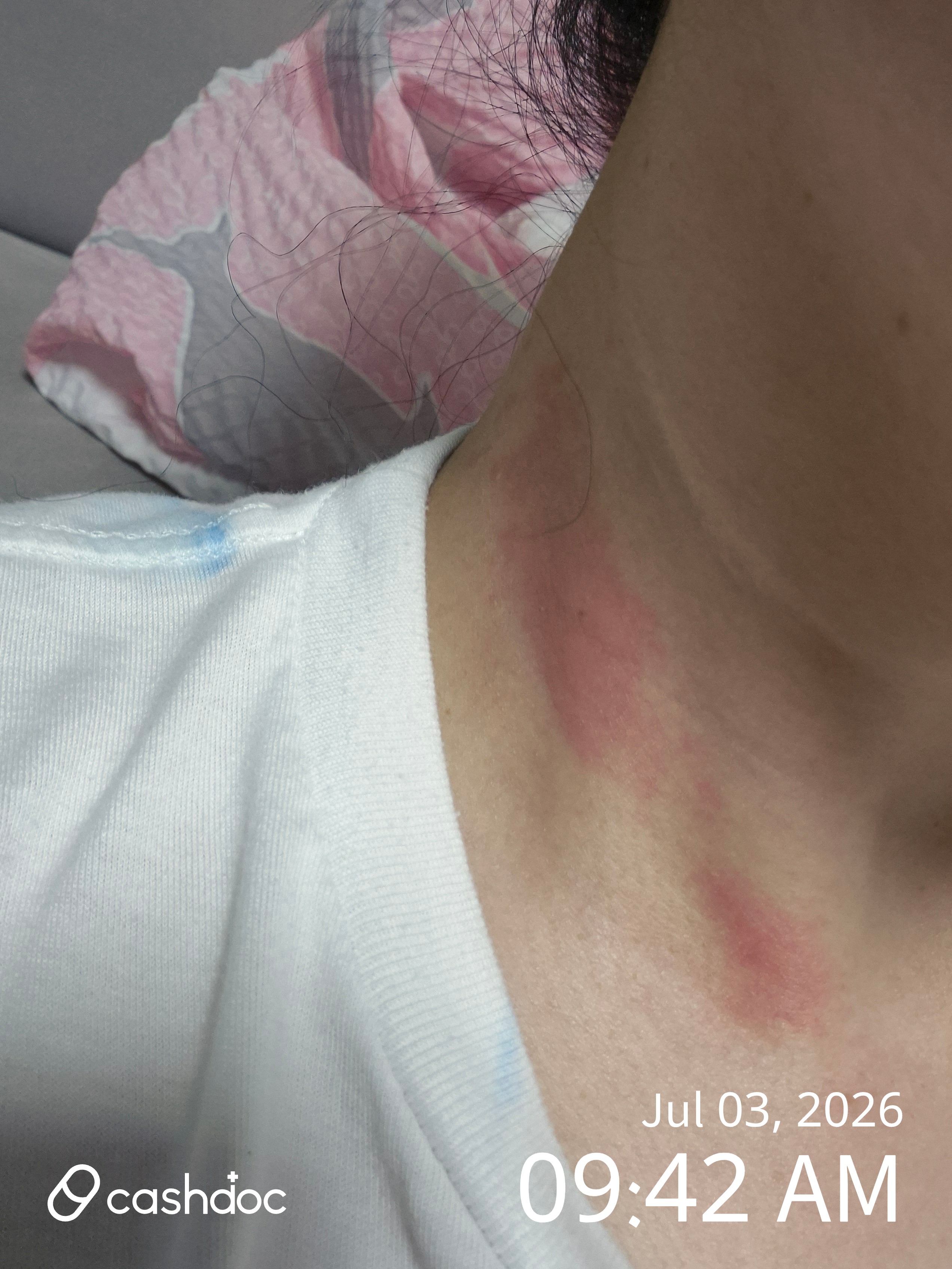 Review photo