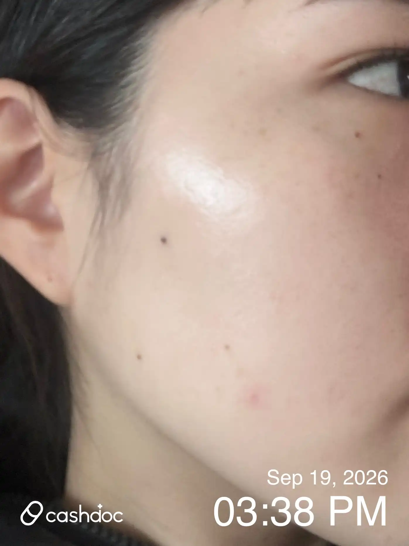 Review photo