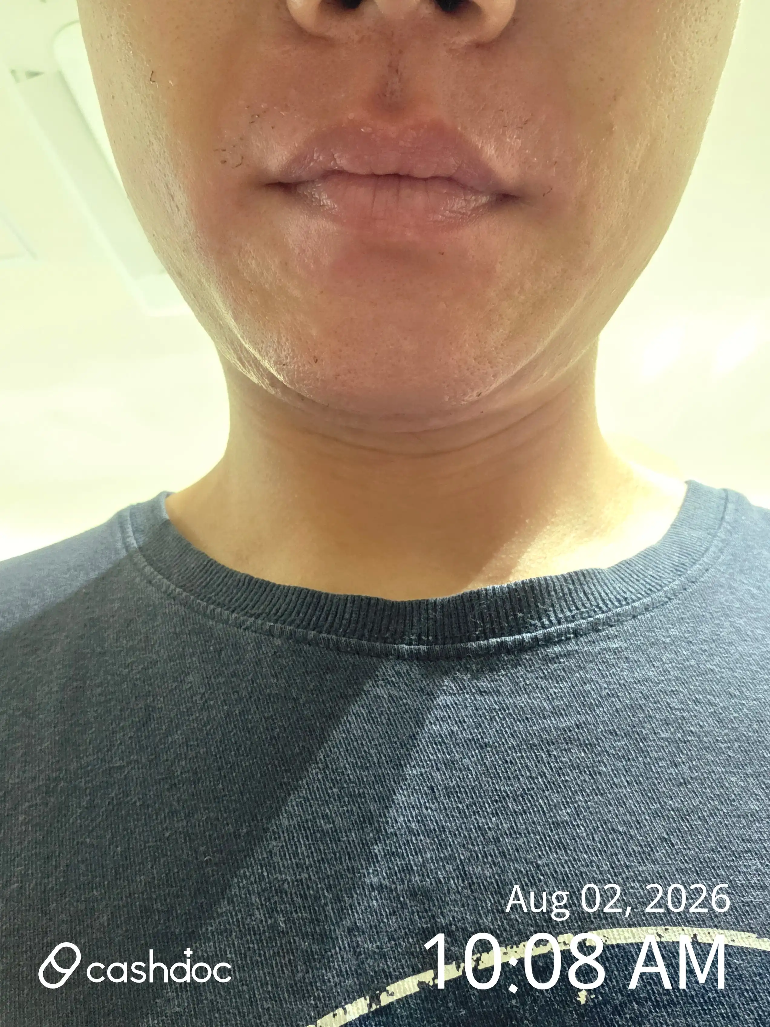 Review photo