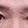 전