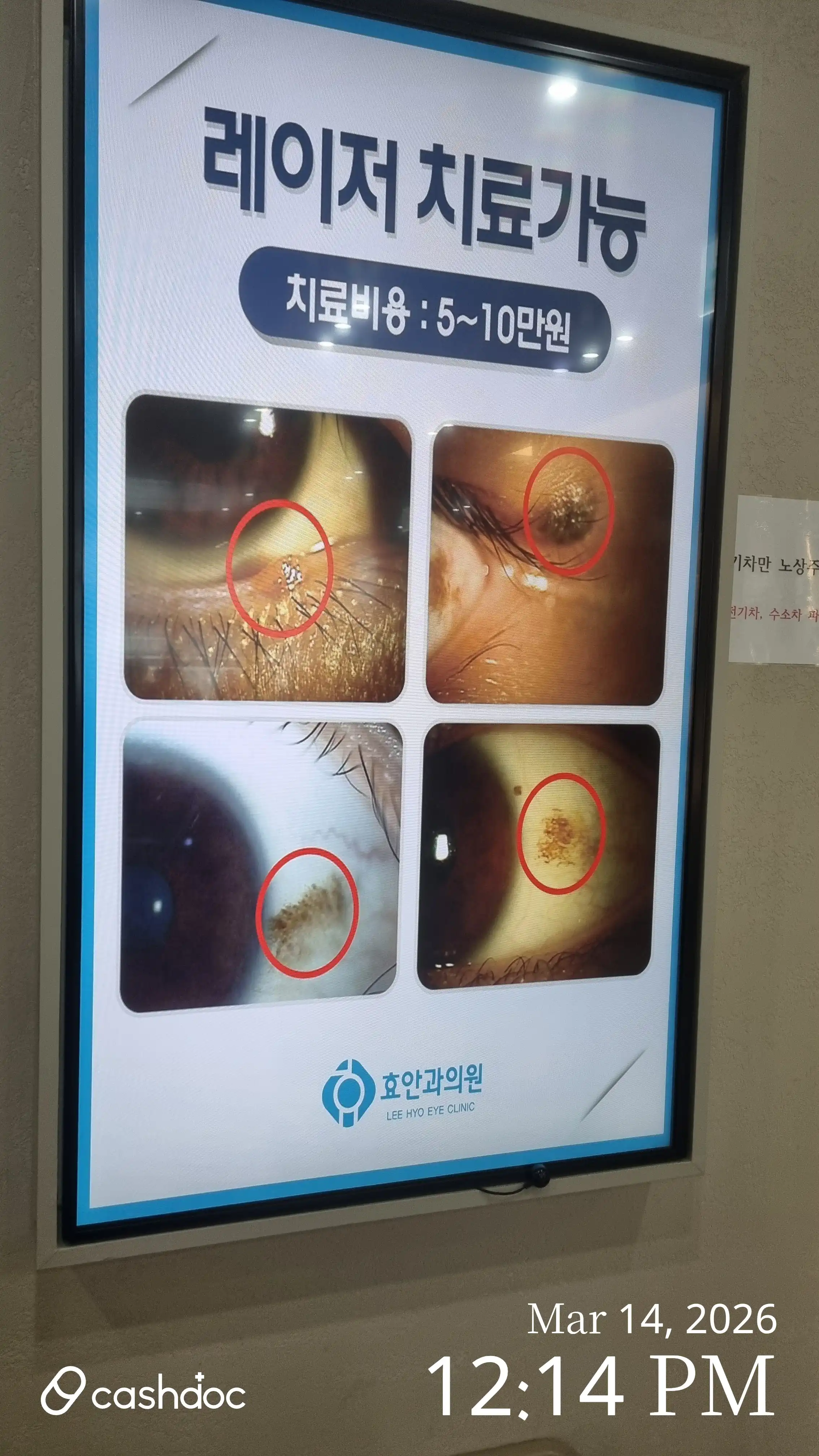Hyo Eye Clinic 2