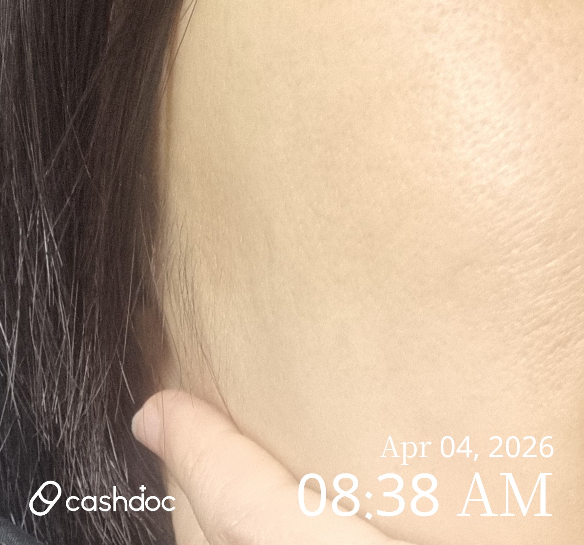 성남시 메이퓨어 수내점, 피코MLA토닝 효과에 놀랐어요