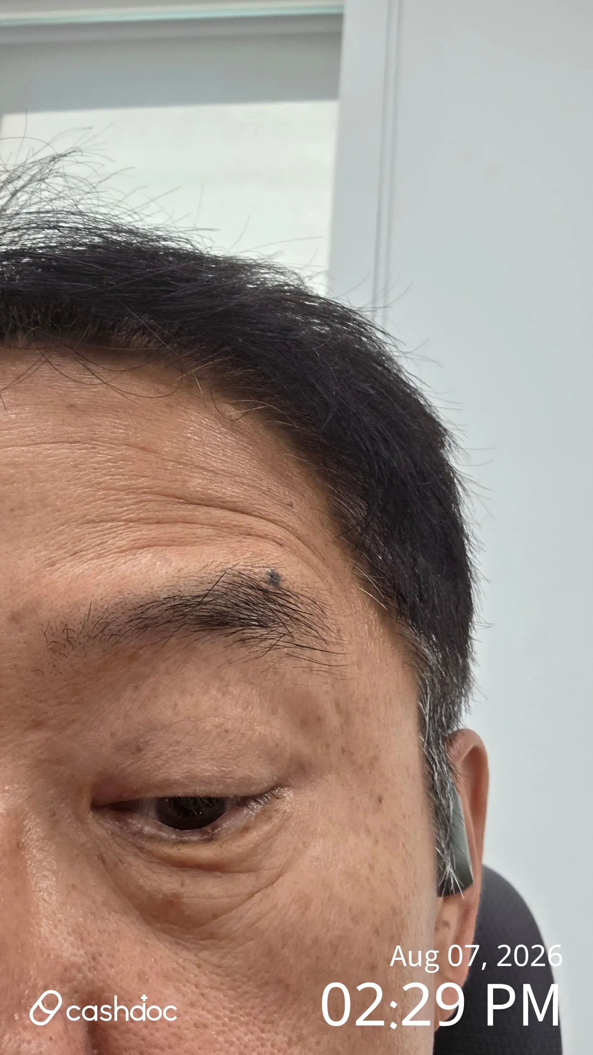 レビュー写真