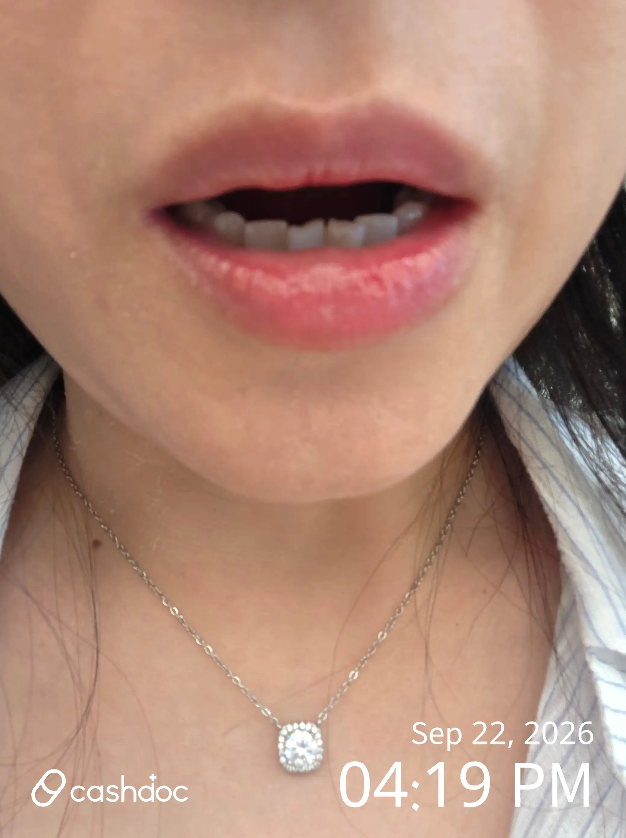 Review photo