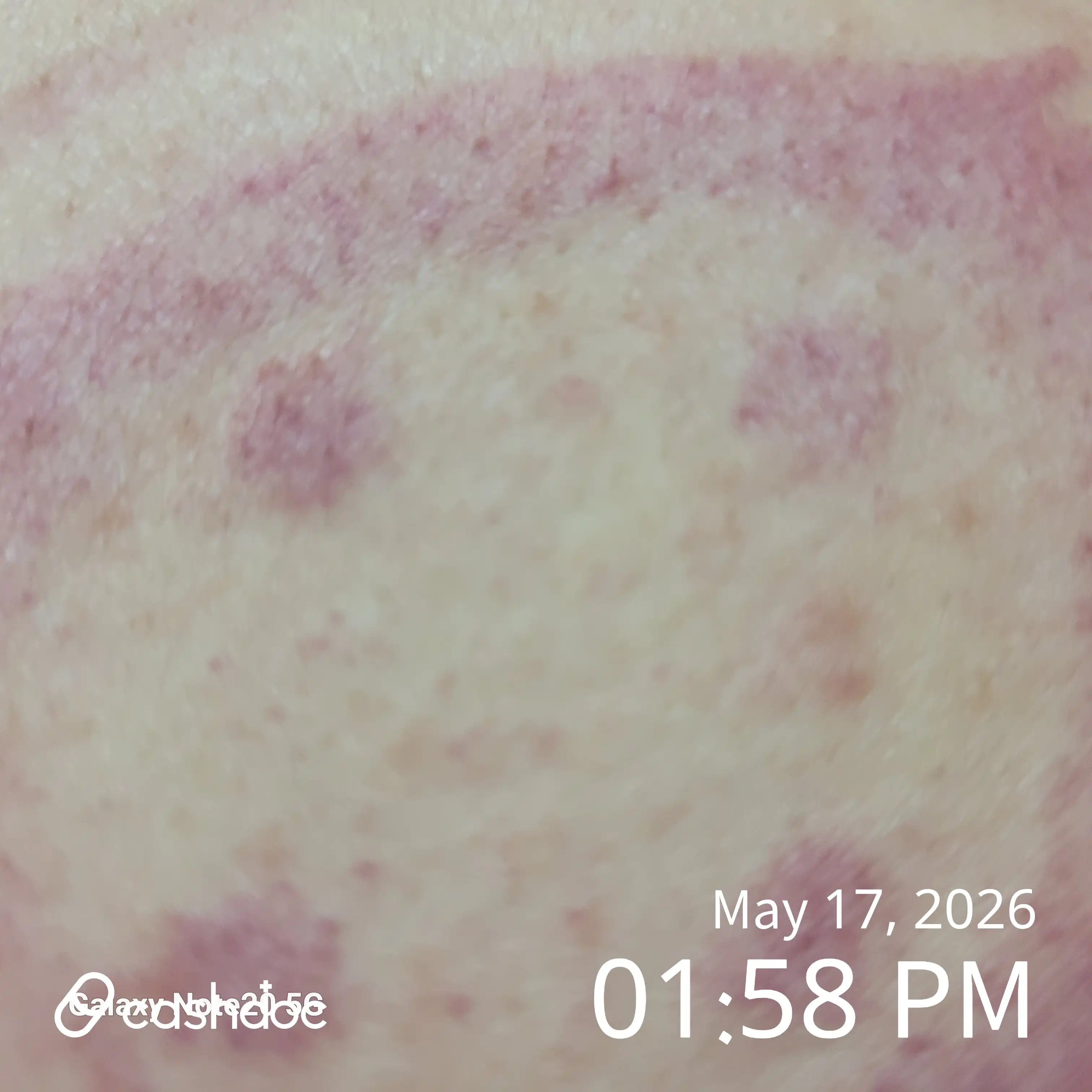 Review photo