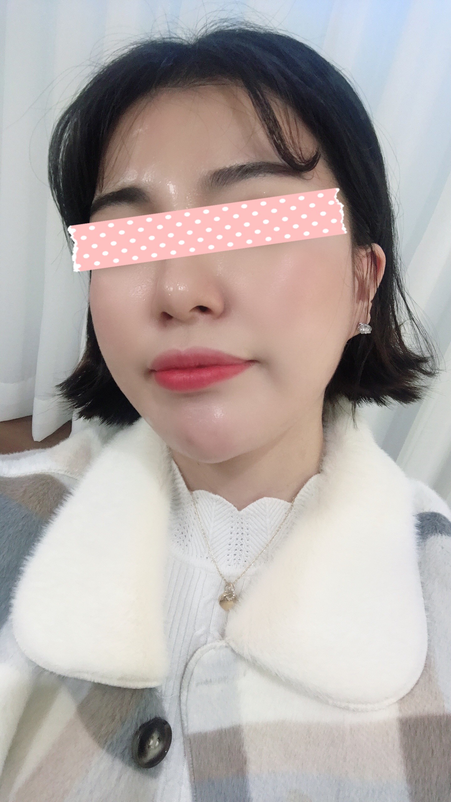 後
