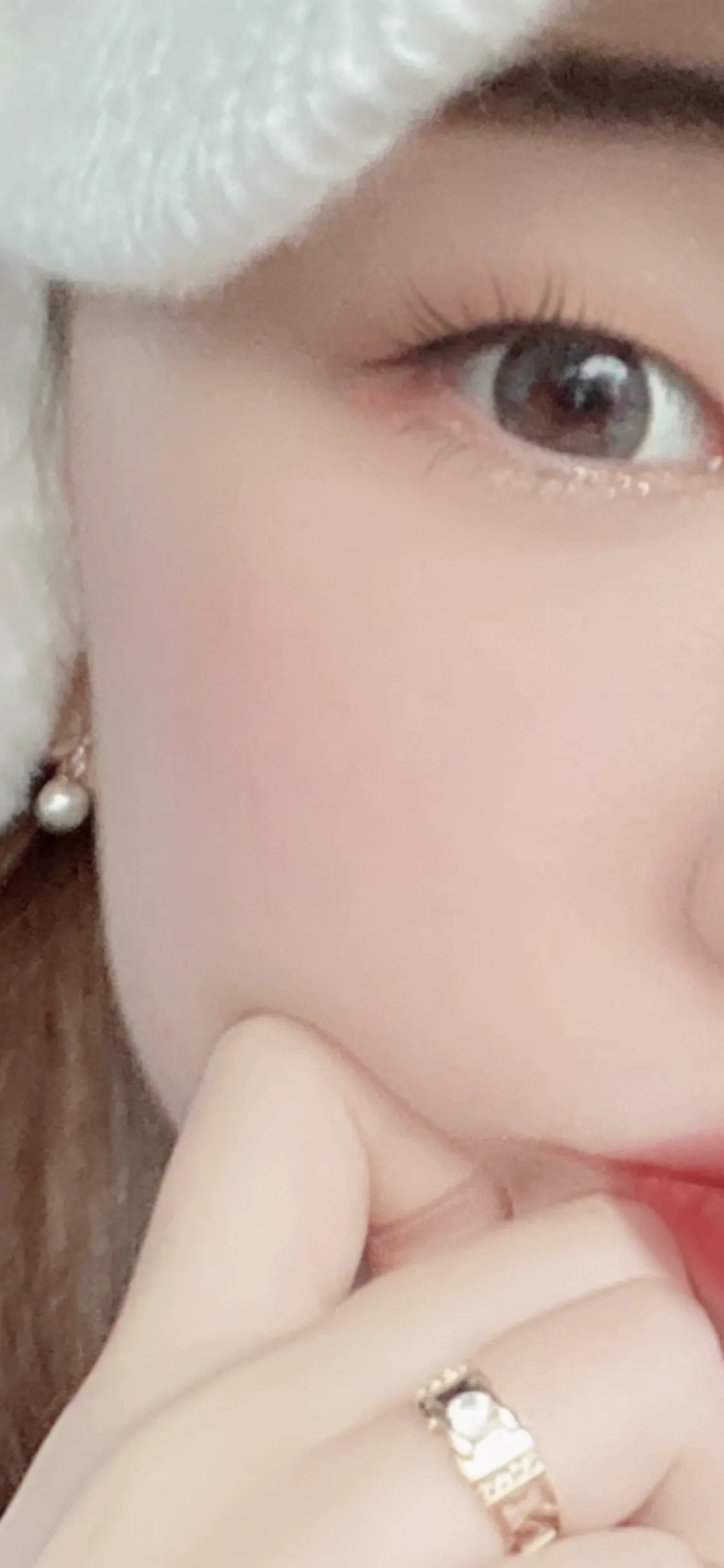 시술 후 — 아쿠아필/마스크트러블 집중관리