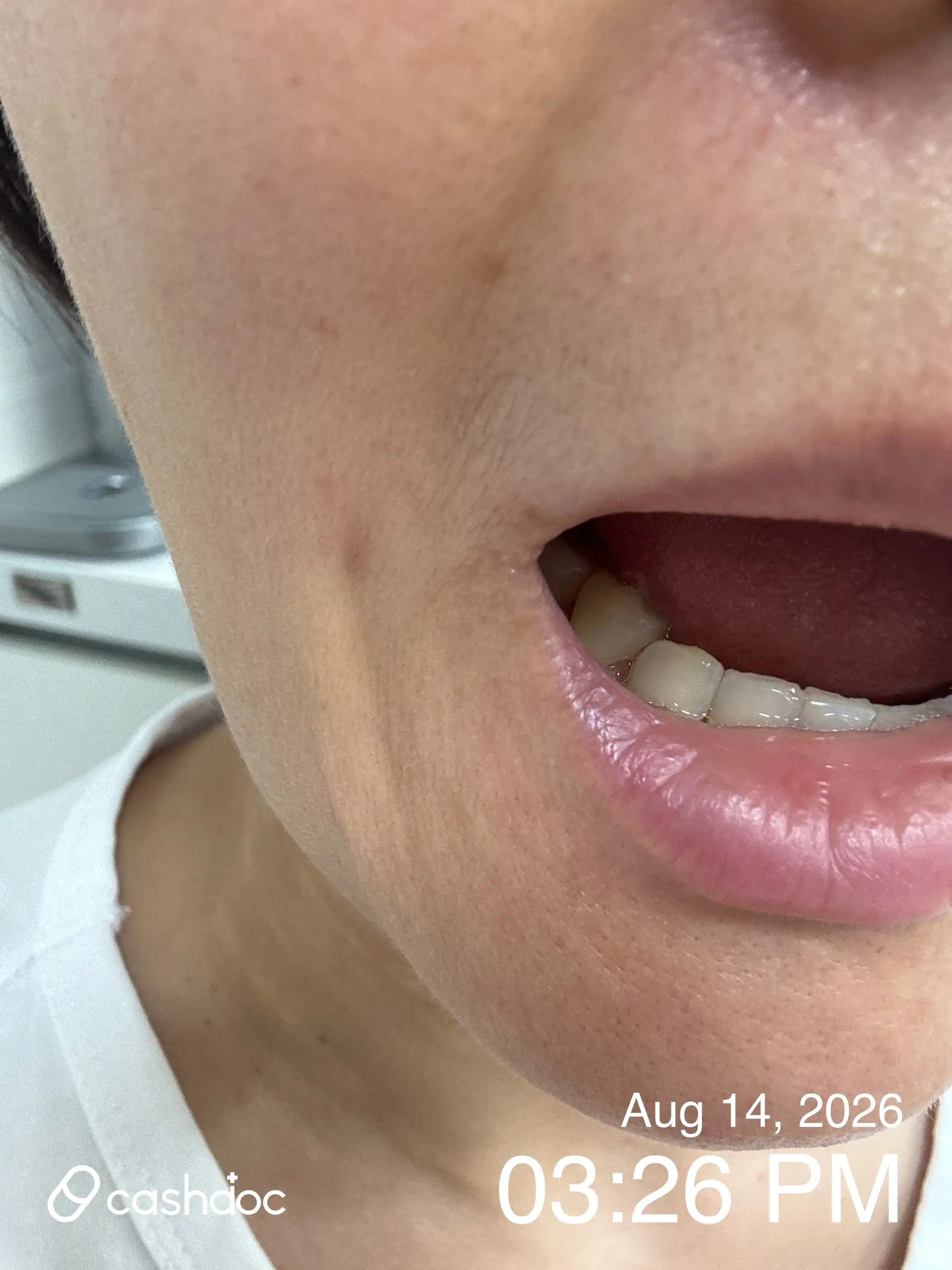 评价照片