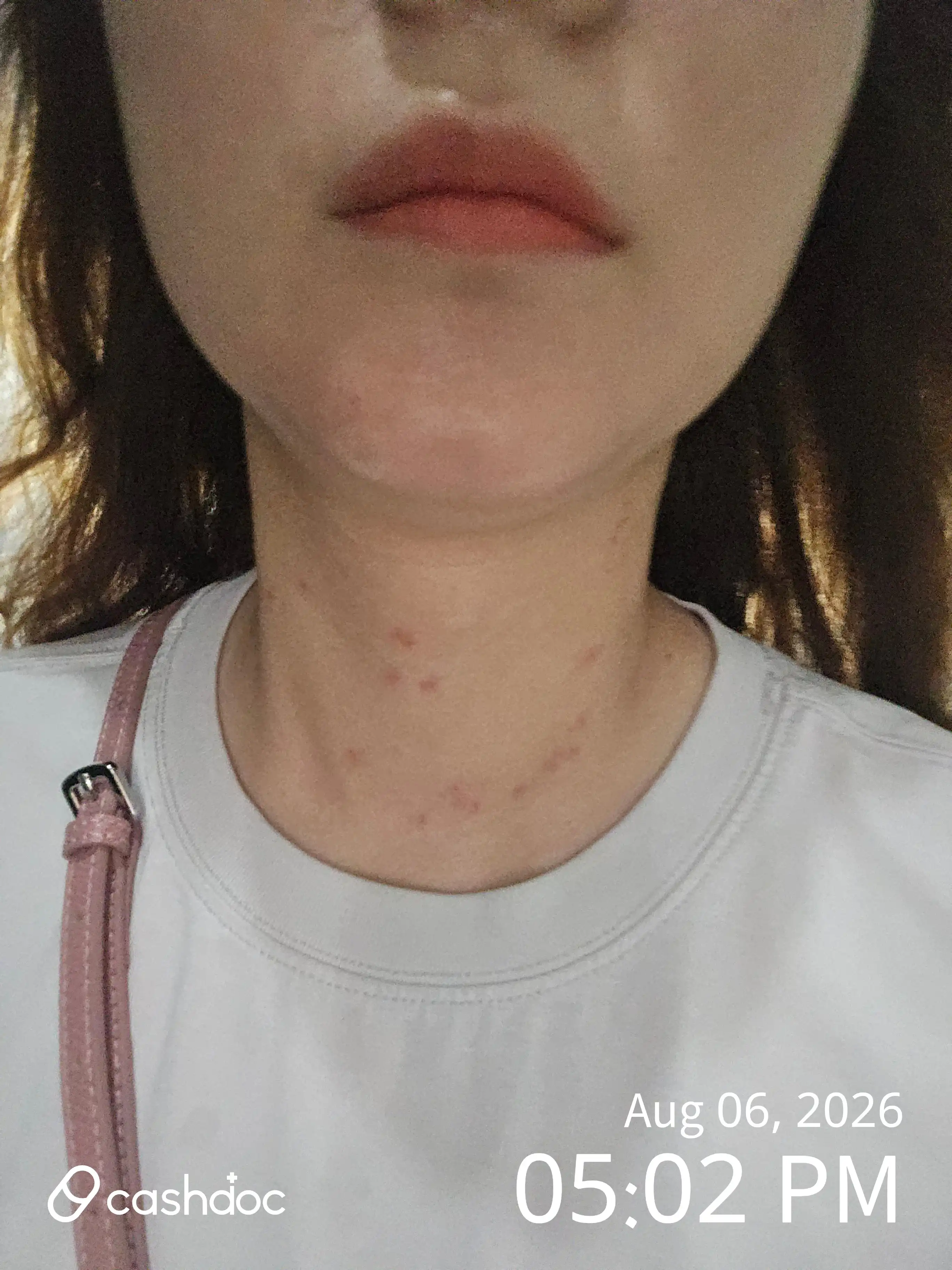 评价照片