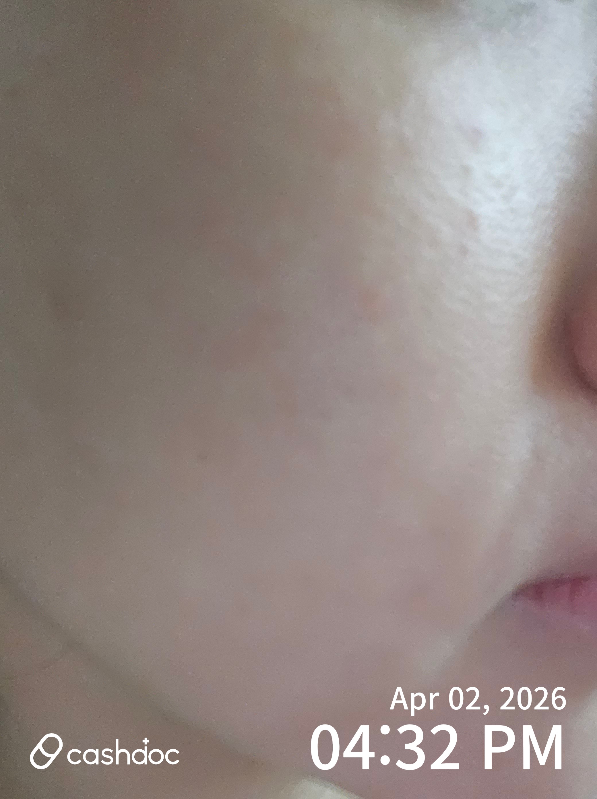 중구 메이퓨어 동대문, 스킨보톡스는 여기서!