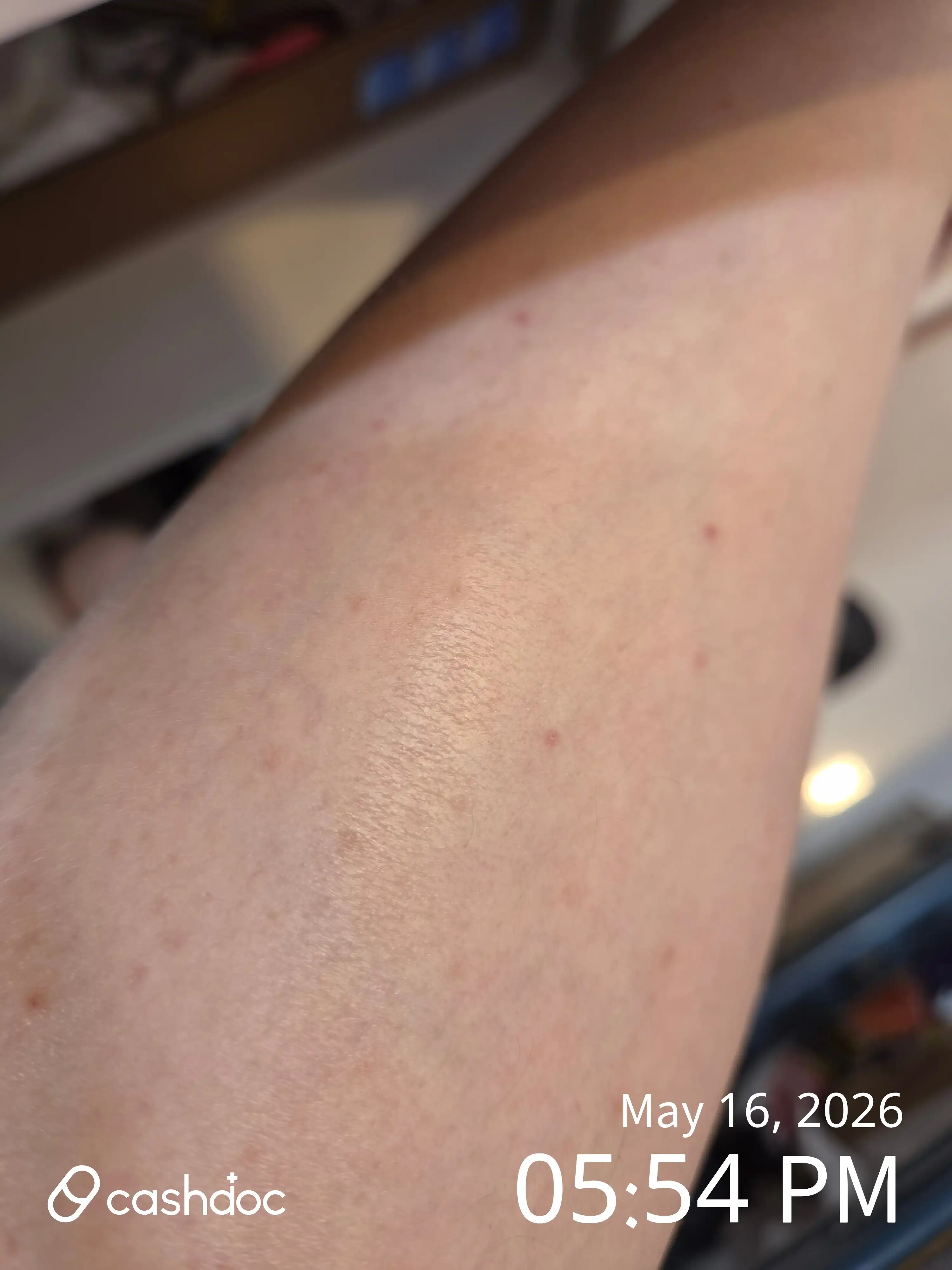 Review photo