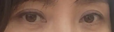후