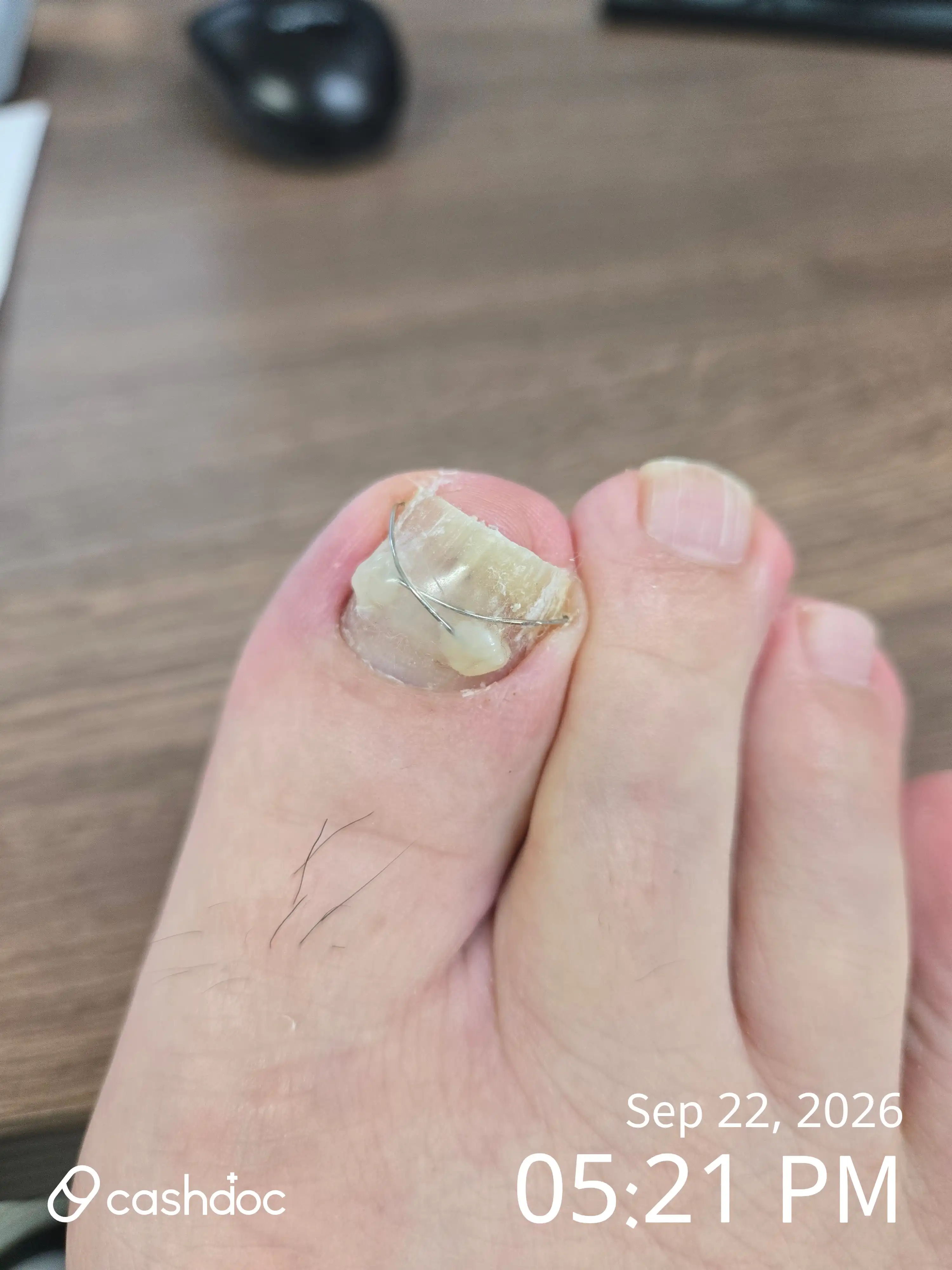 Review photo