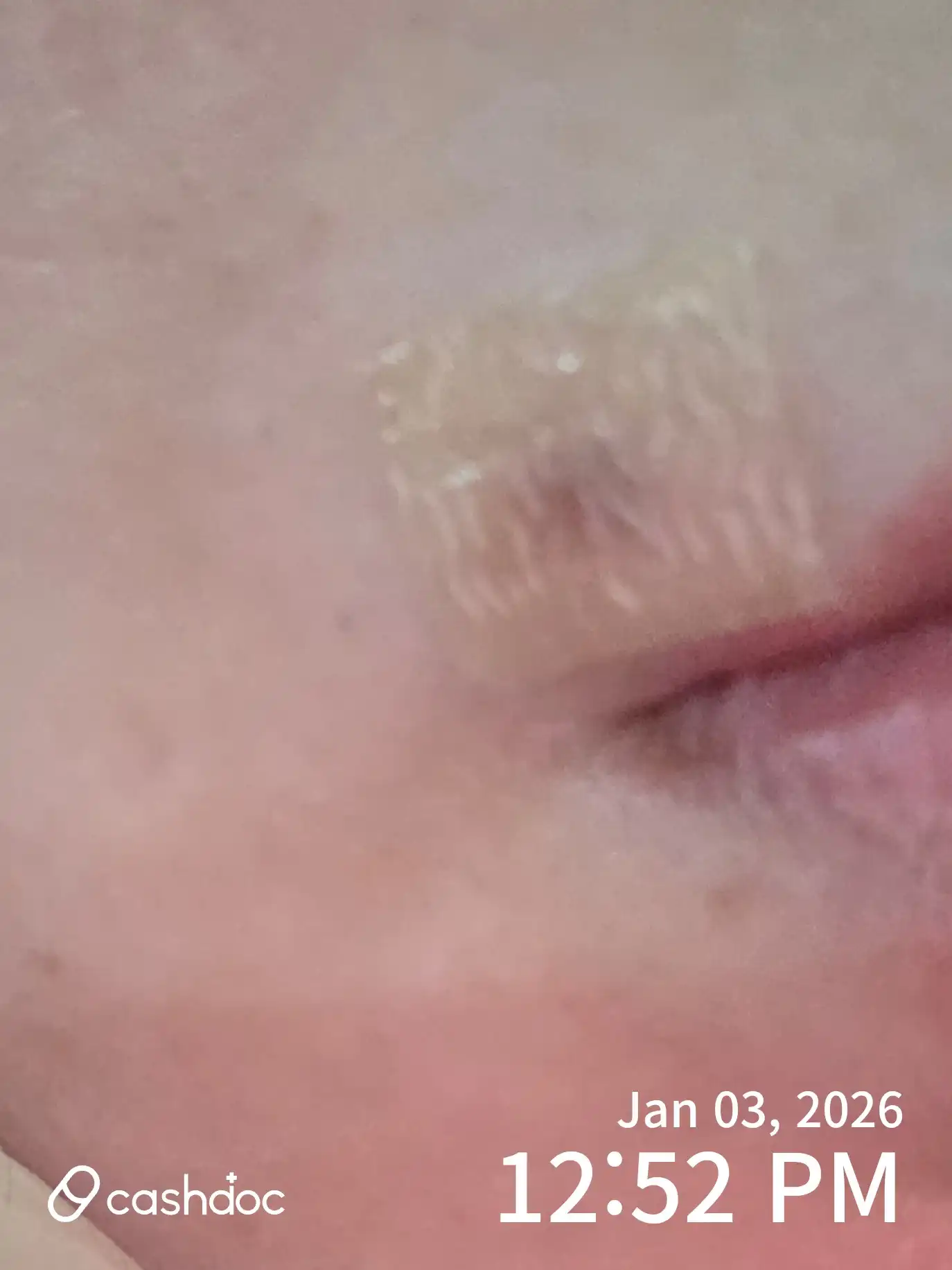 评价照片