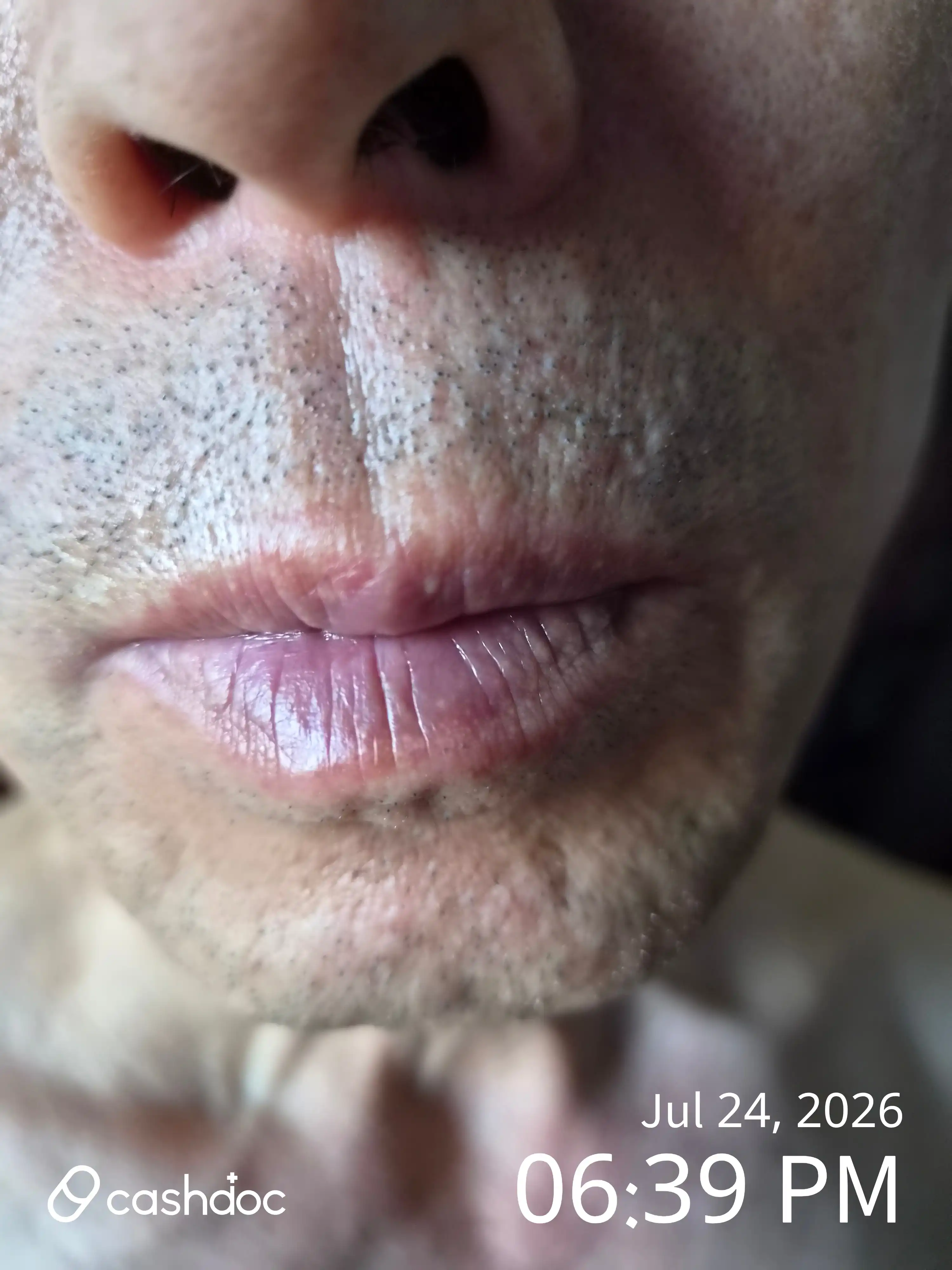 评价照片