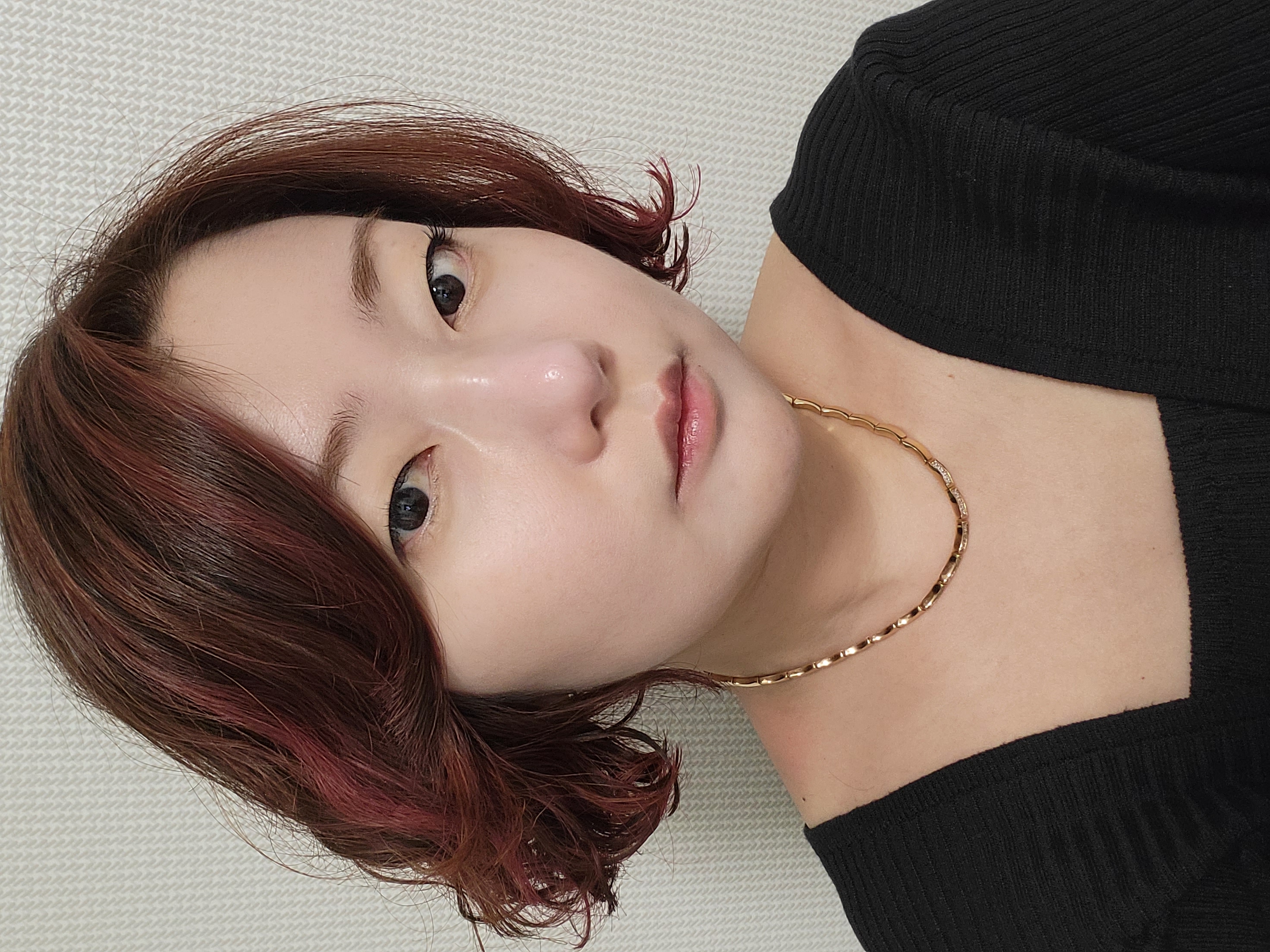 施術前 — 呼吸がしやすい機能的な鼻の手術
