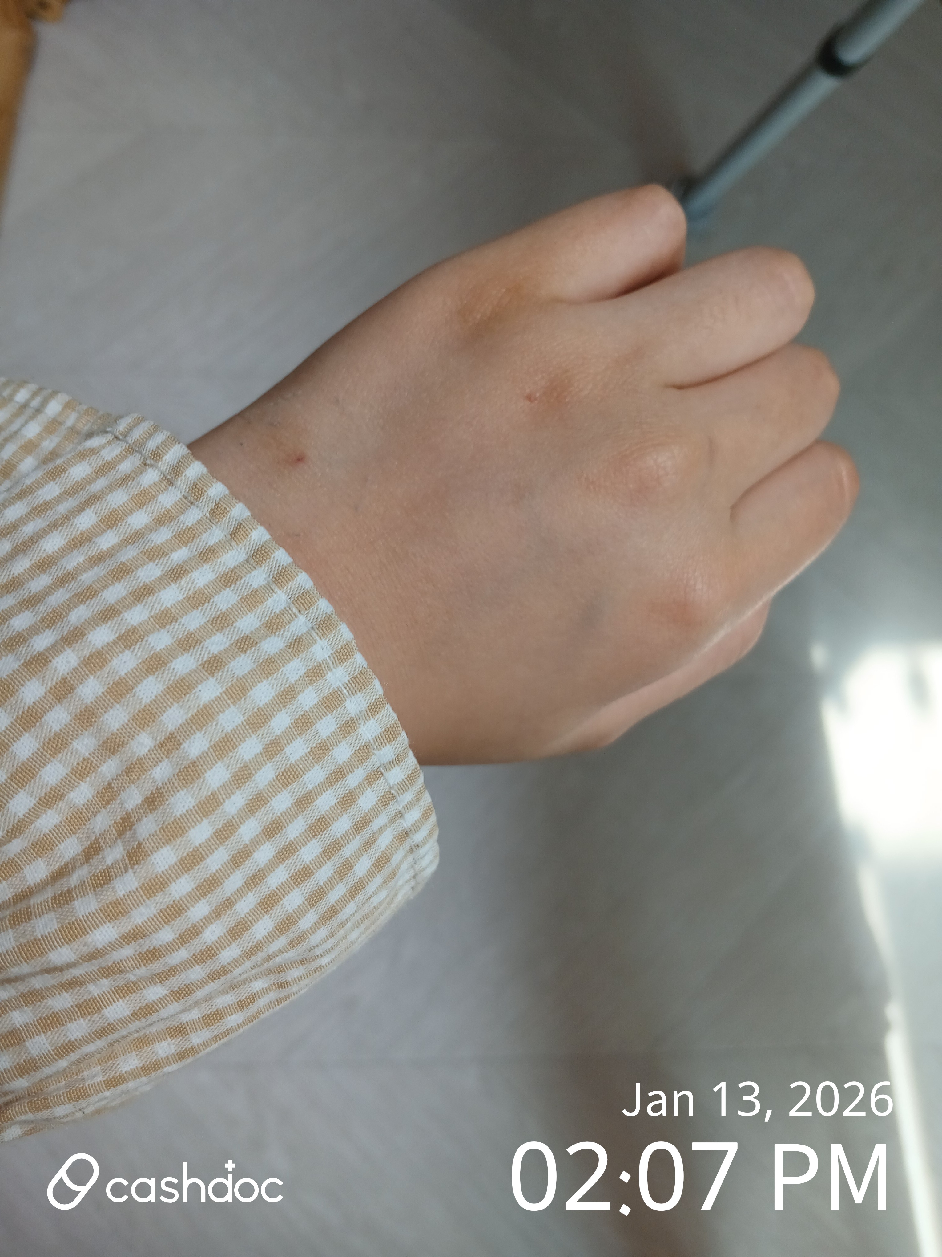 북구 칠곡경대병원 응급실, 감기 증상 해결 후 꿀잠!