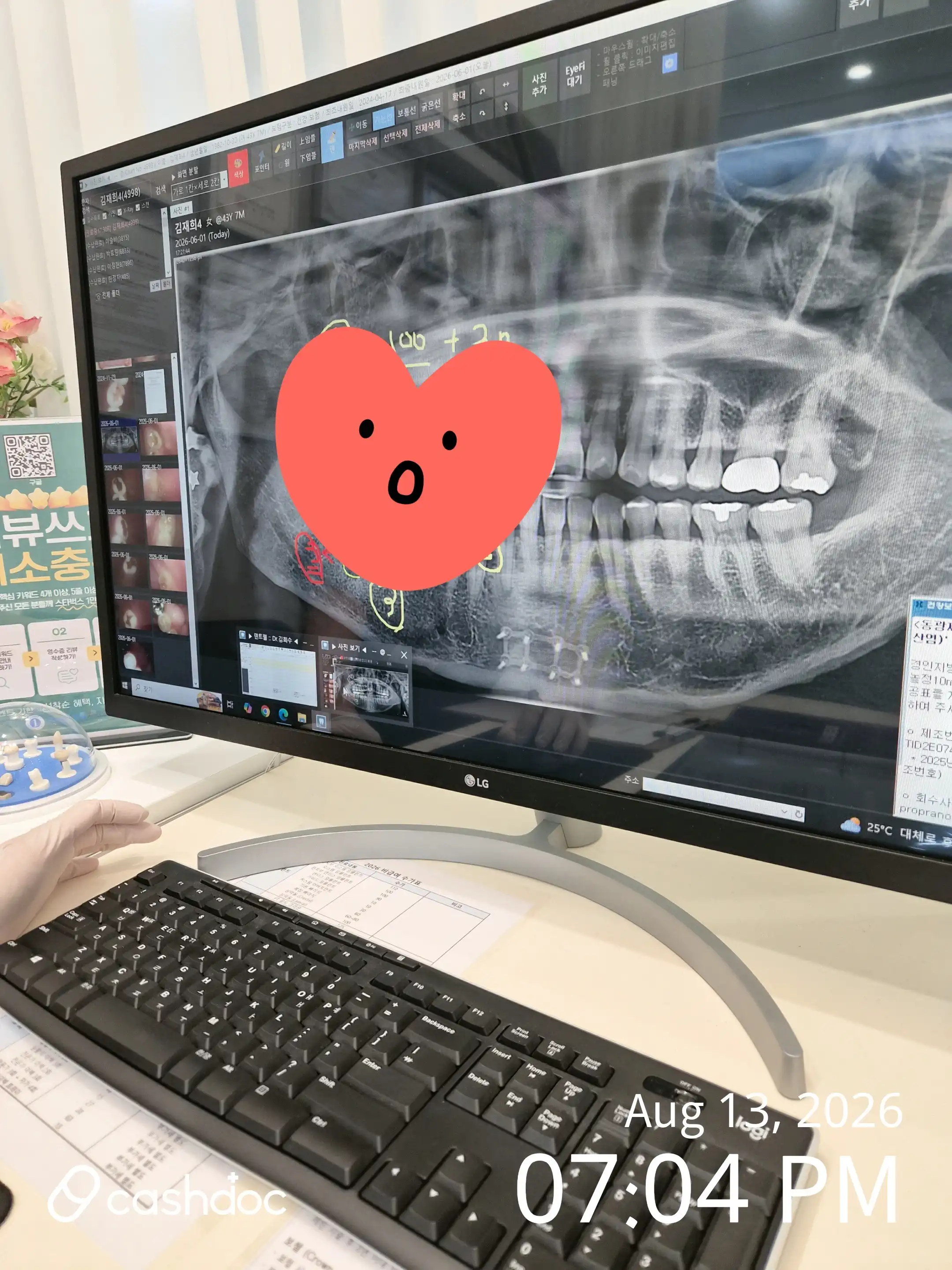 レビュー写真