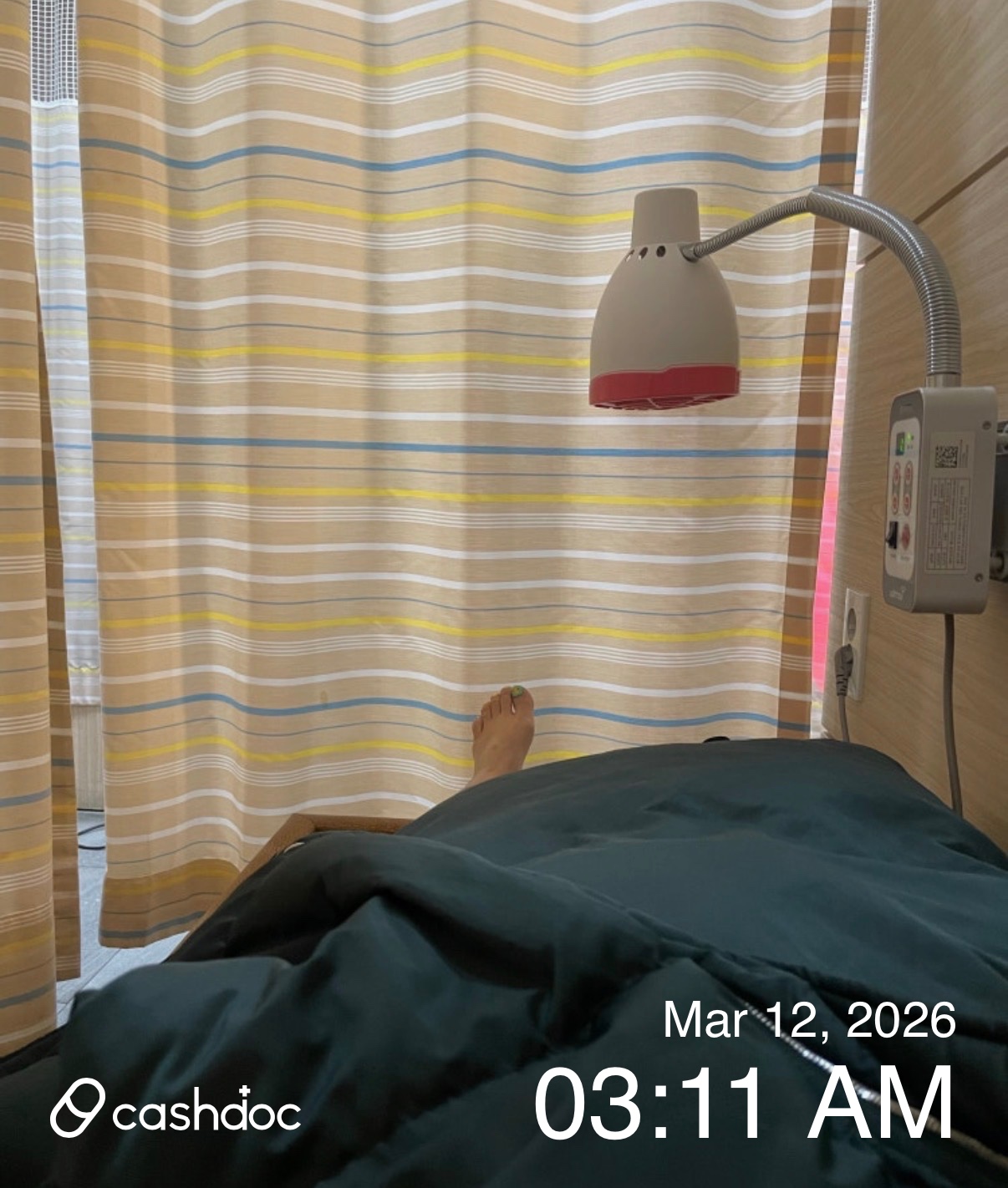 중구 신당스카이정형외과의원, 발가락 통증 치료 후기