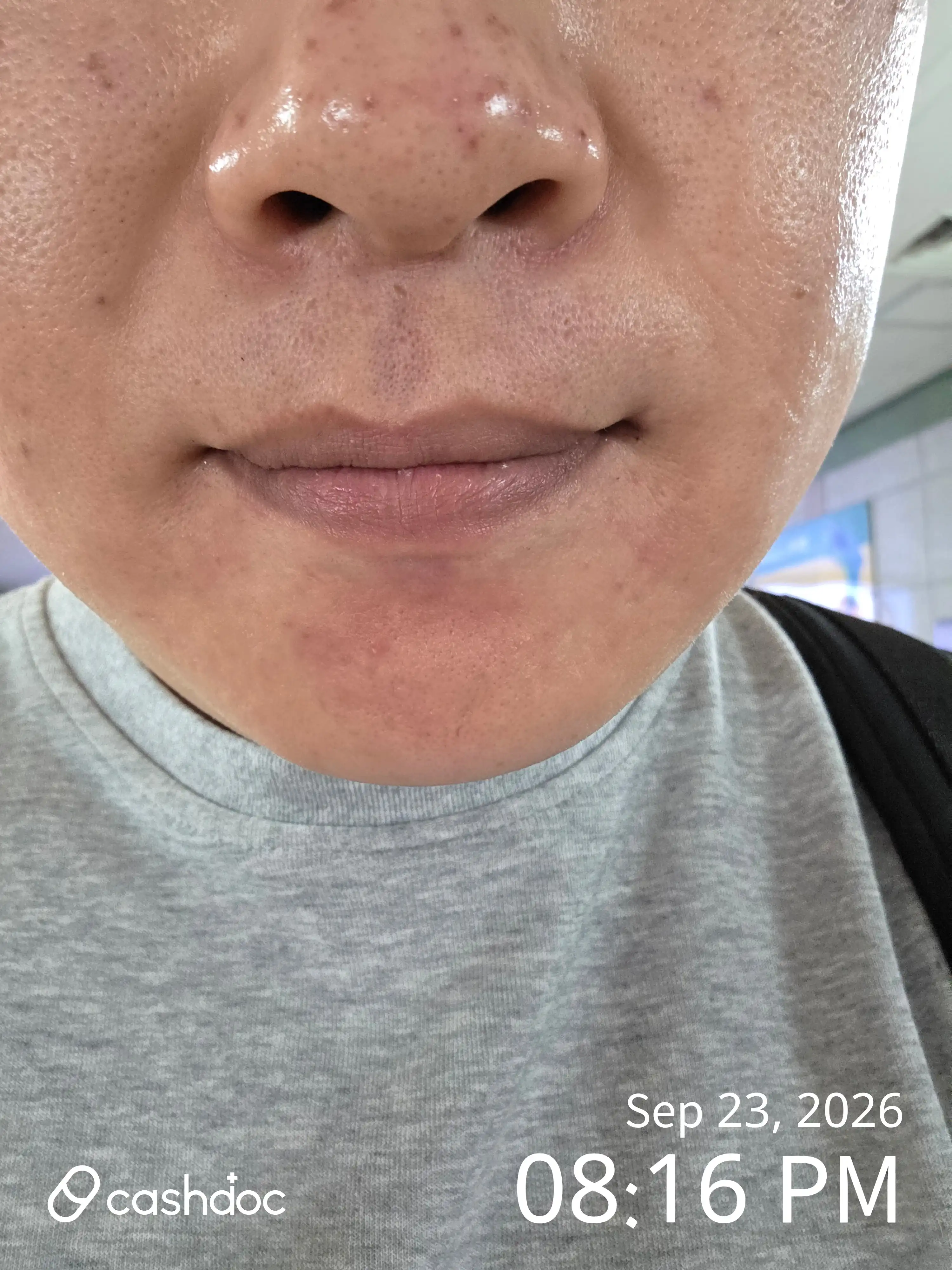 Review photo