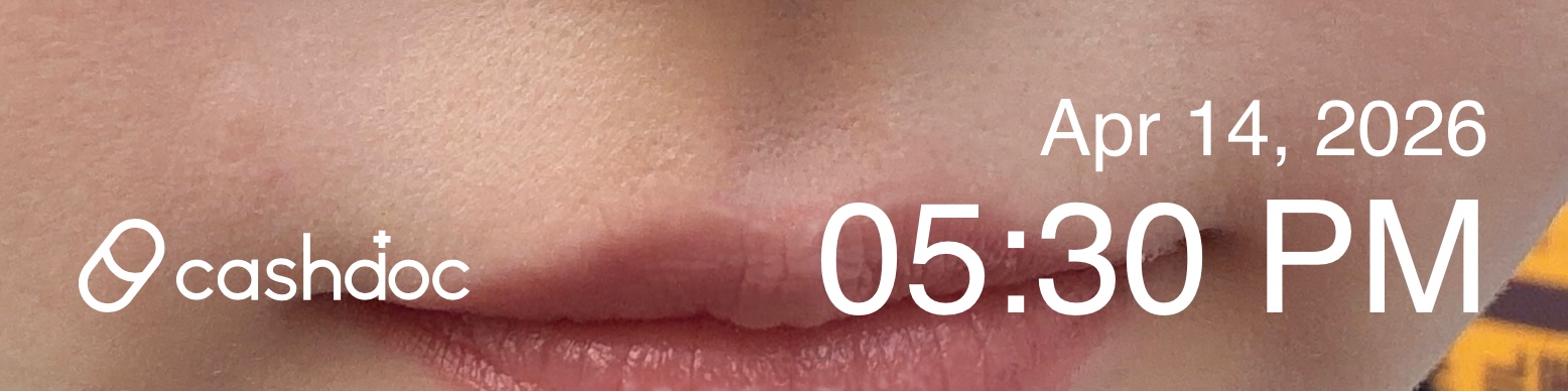 강남구 모리스의원에서 만족스러운 레이저제모 경험