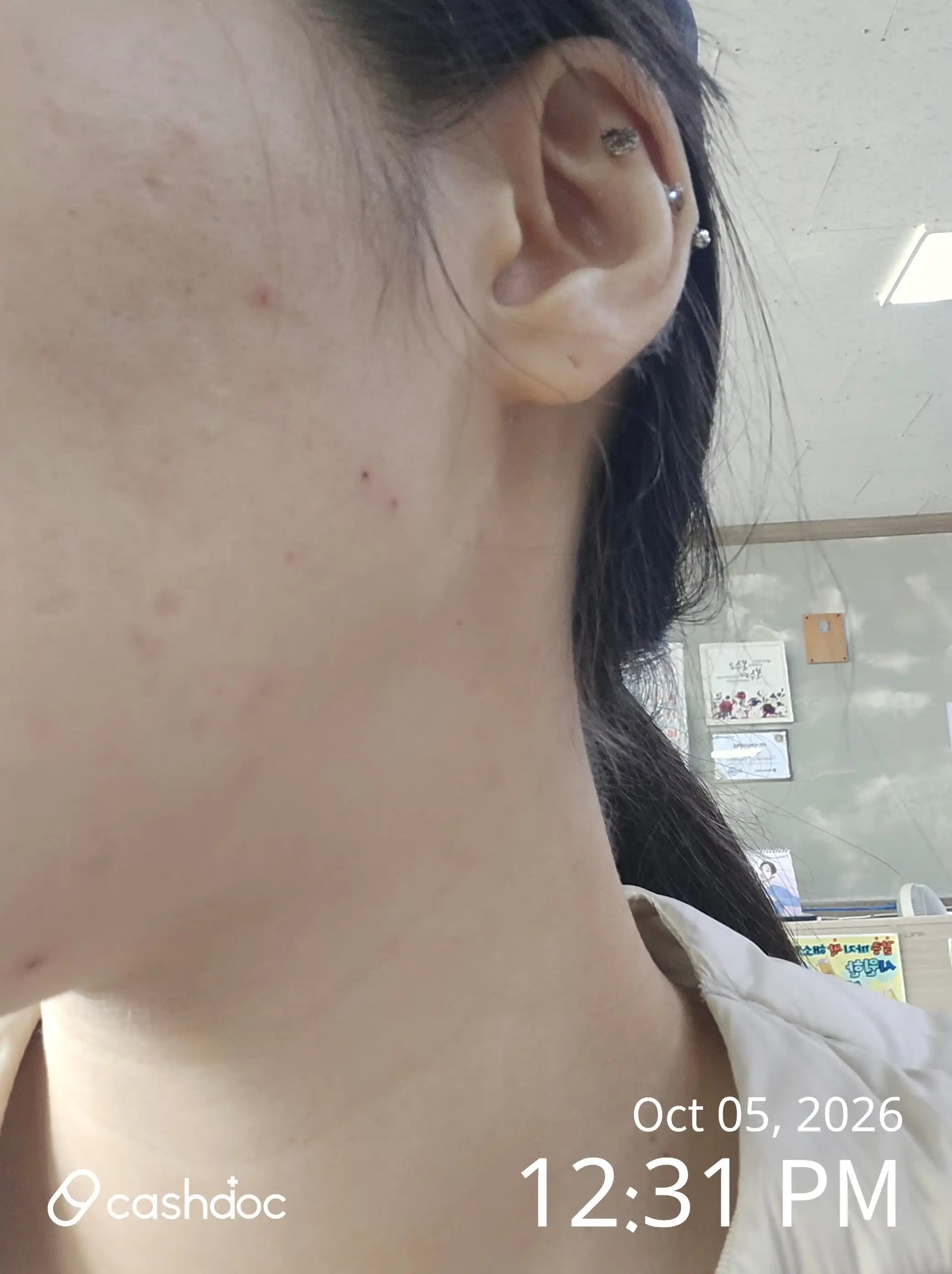 Review photo