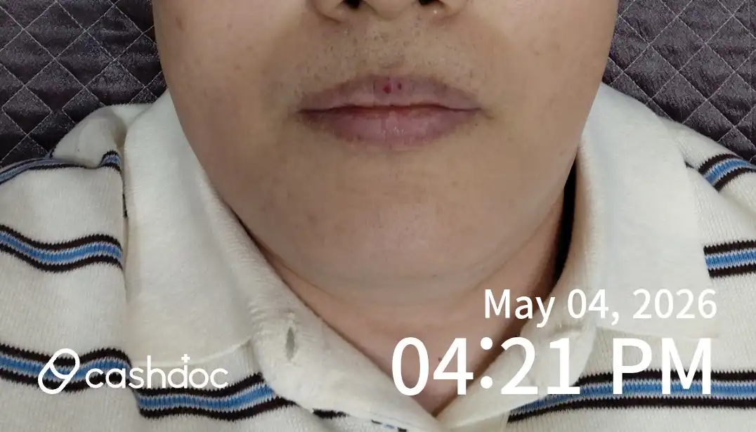 Review photo