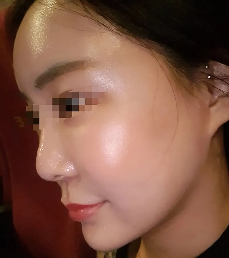 After treatment — Pain Reduction - Special Offer on #RejuranHealer