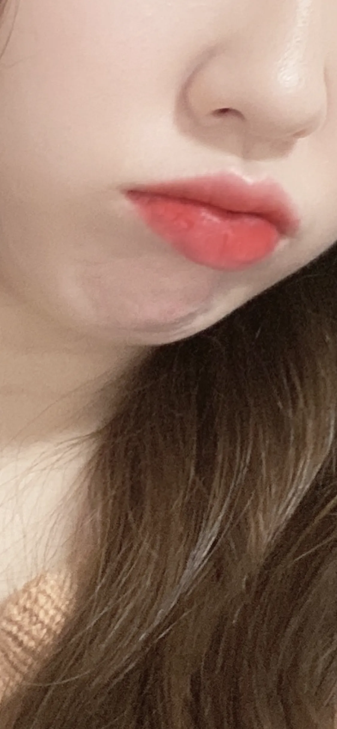 시술 전 사진